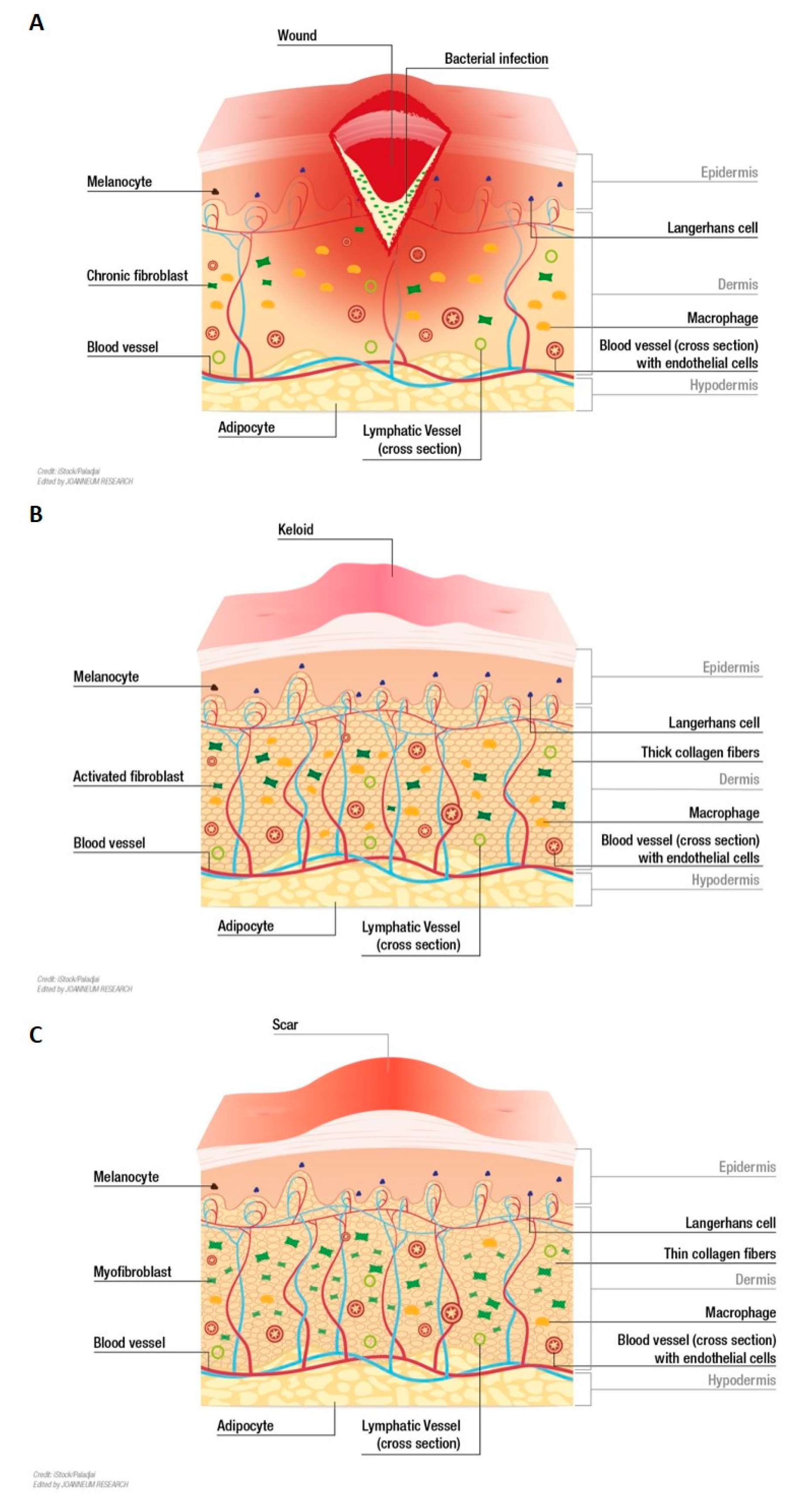 Hellere uddanne par Biomedicines | Free Full-Text | Human In Vitro Skin Models for Wound Healing  and Wound Healing Disorders