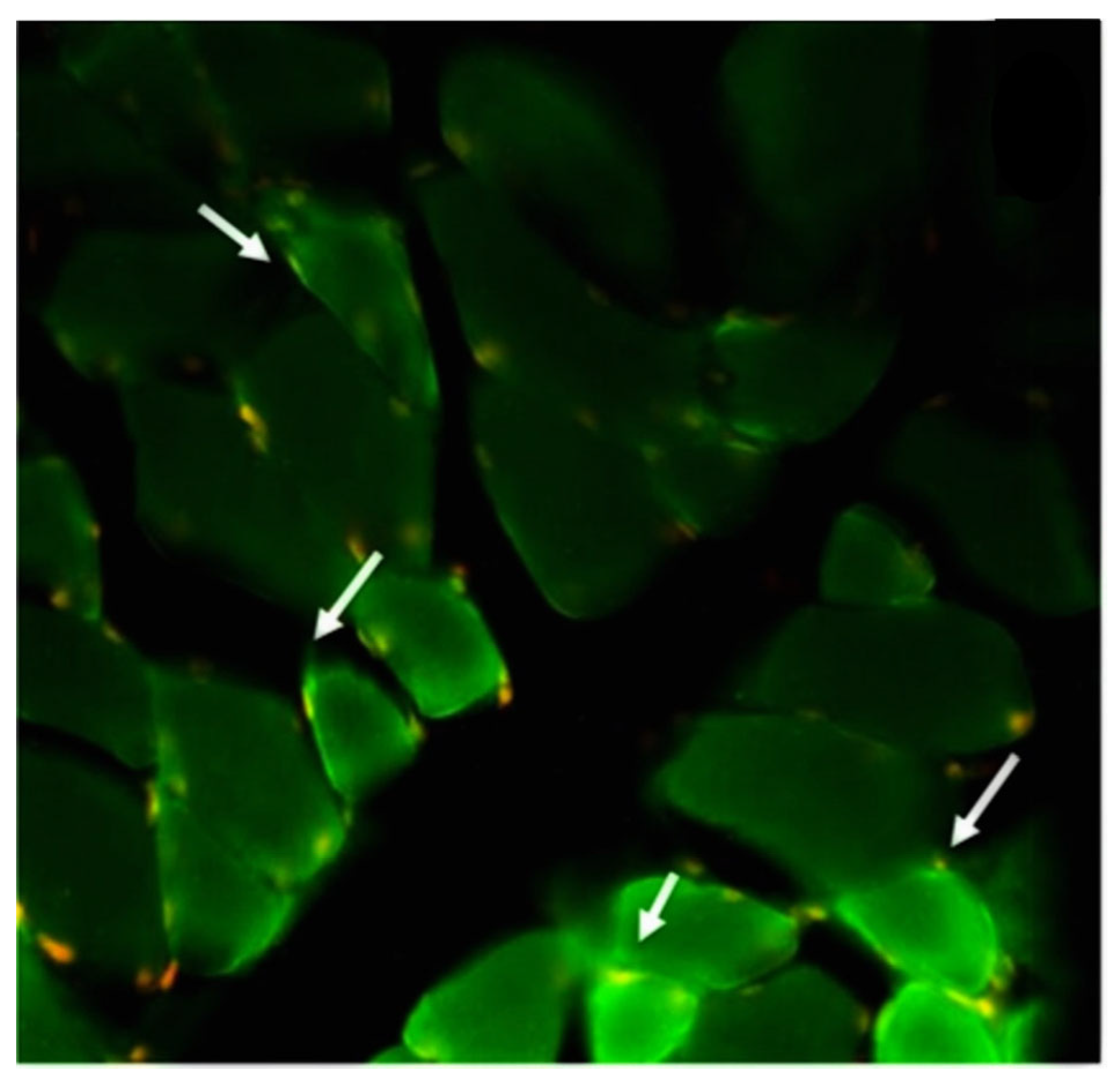 Biomedicines Free Full Text New Onset Autoimmune Diseases After The   Biomedicines 11 01898 G001 