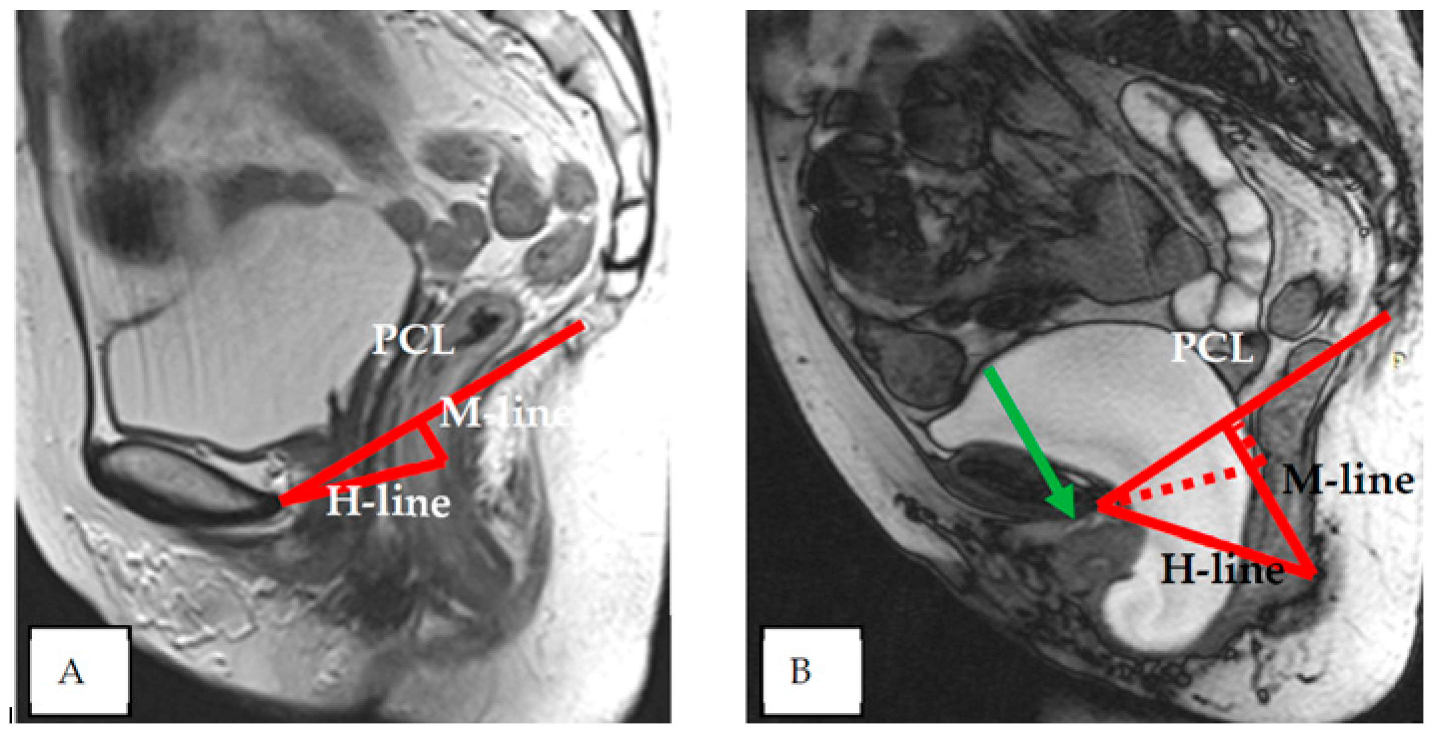 Diagnostic Value Of Dynamic Magnetic Resonance Imaging dMRI Of The Diagnostic Value Of Dynamic Magnetic Resonance Imaging dMRI Of The