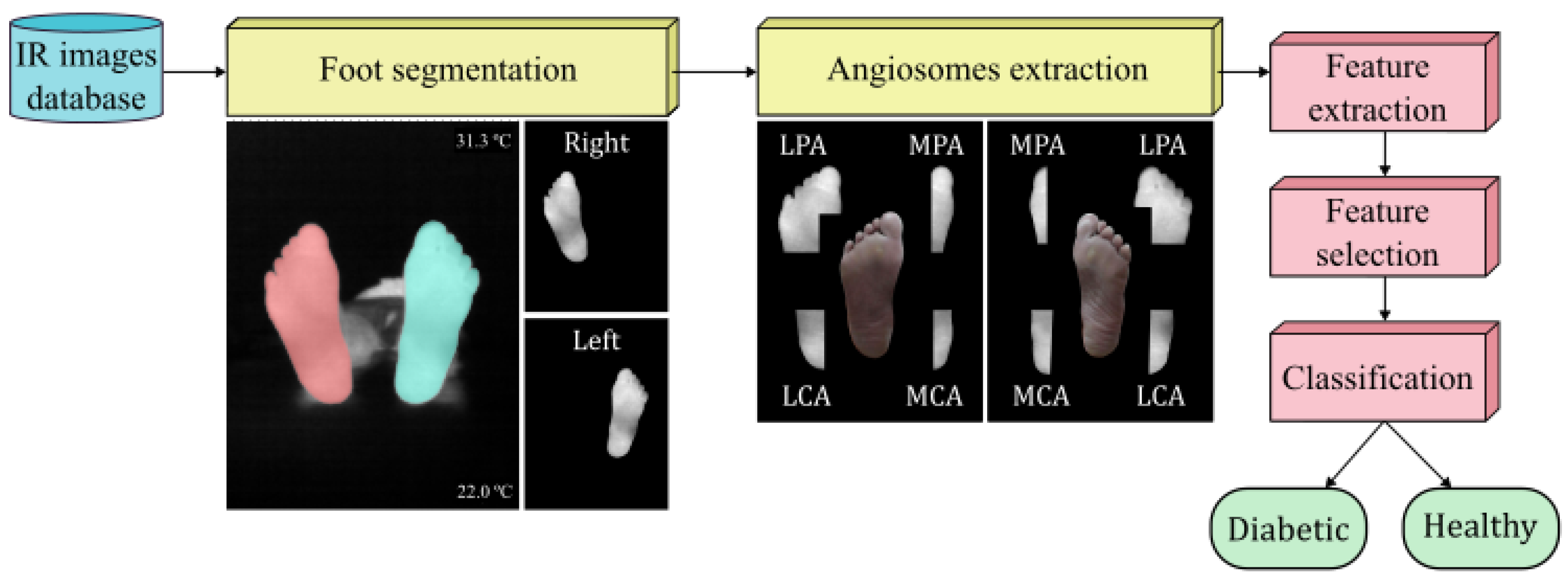 Biomedicines | Free Full-Text | State-of-the-Art Features for Early-Stage  Detection of Diabetic Foot Ulcers Based on Thermograms