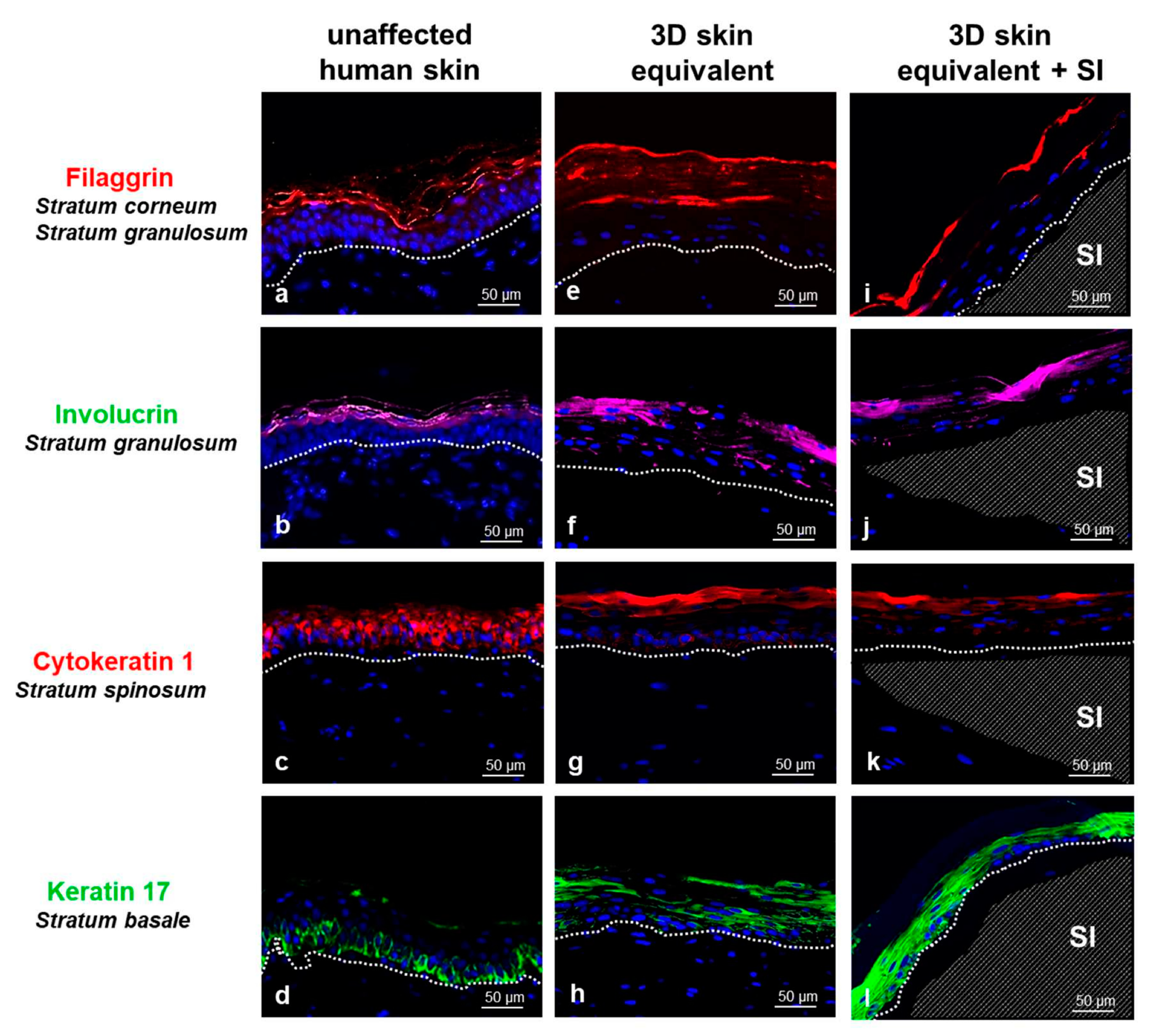 How the surfaces of silicone breast implants affect the immune system, MIT  News