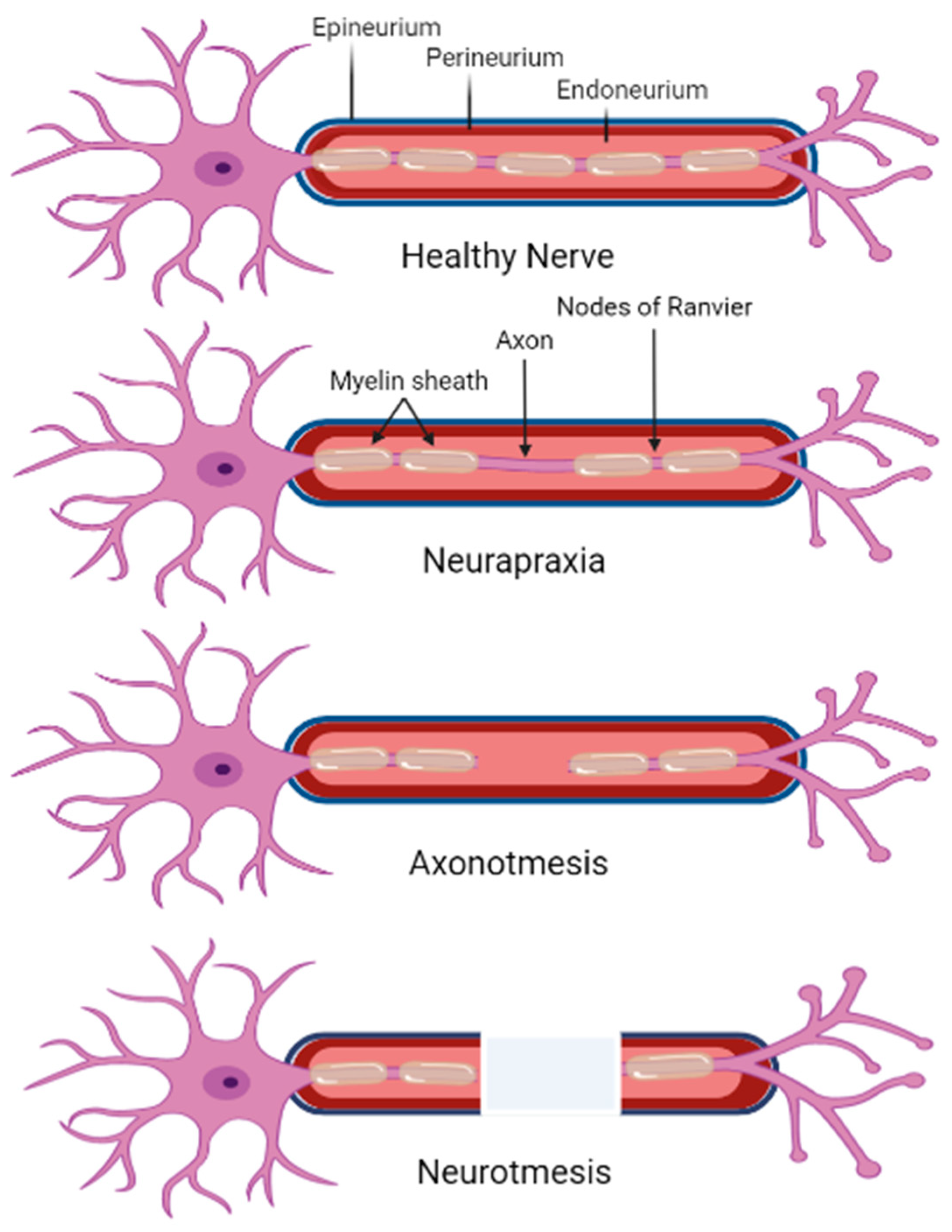 Biomedicines | Free Full-Text | Effects of Physical Cues on Stem  Cell-Derived Extracellular Vesicles toward Neuropathy Applications