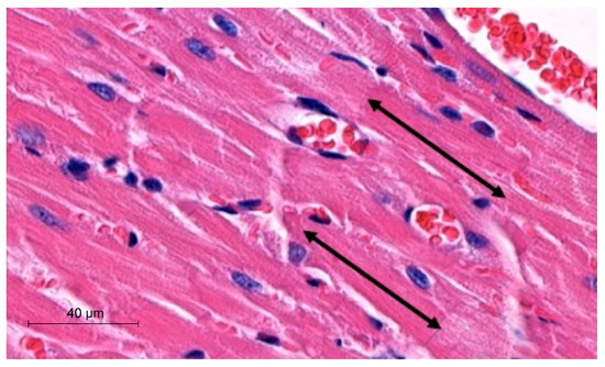 Immunolocalization of Matrix Metalloproteinases 2 and 9 and Their ...
