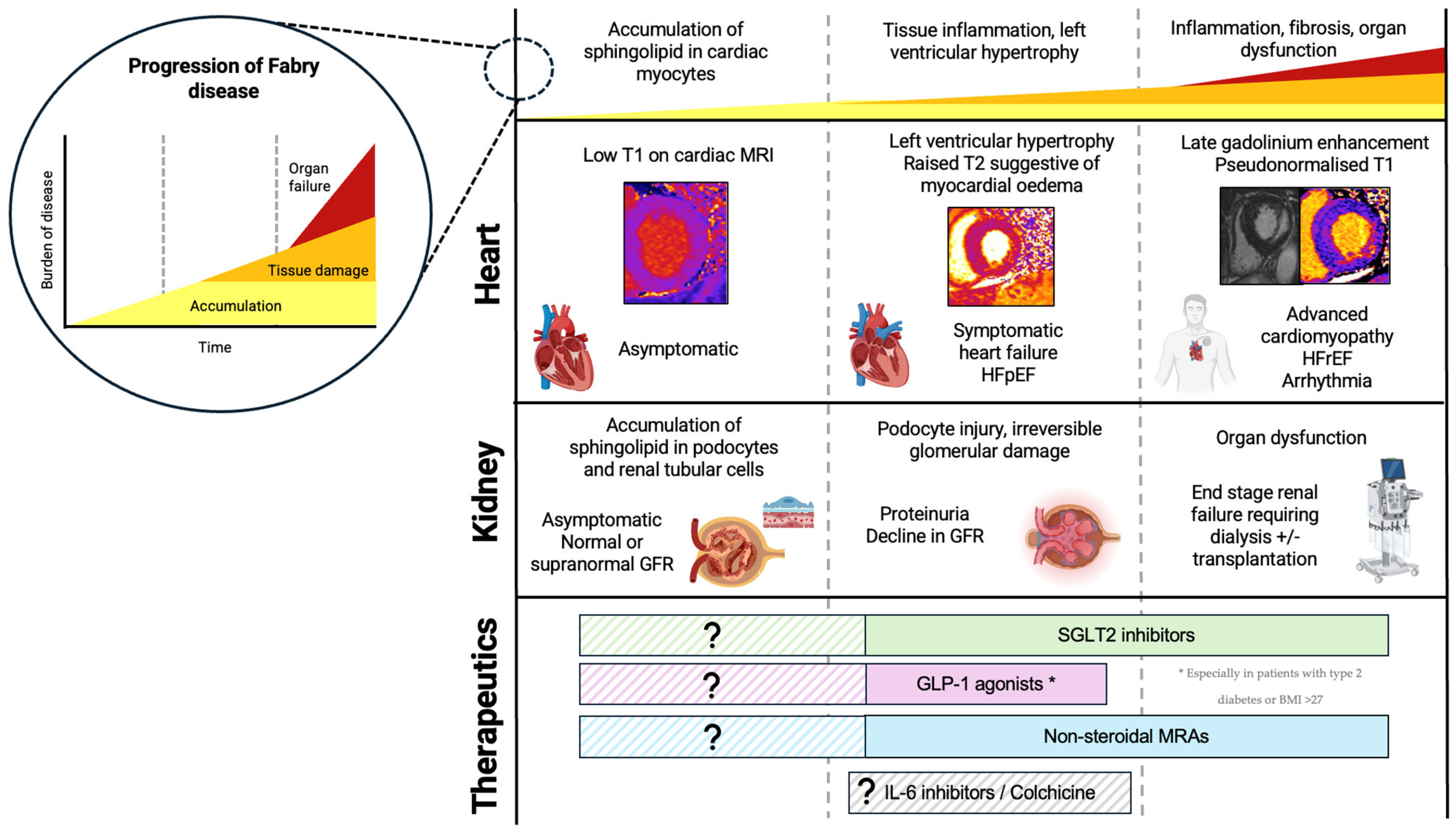 Fabry Disease: Insights into Pathophysiology and Novel Therapeutic ...