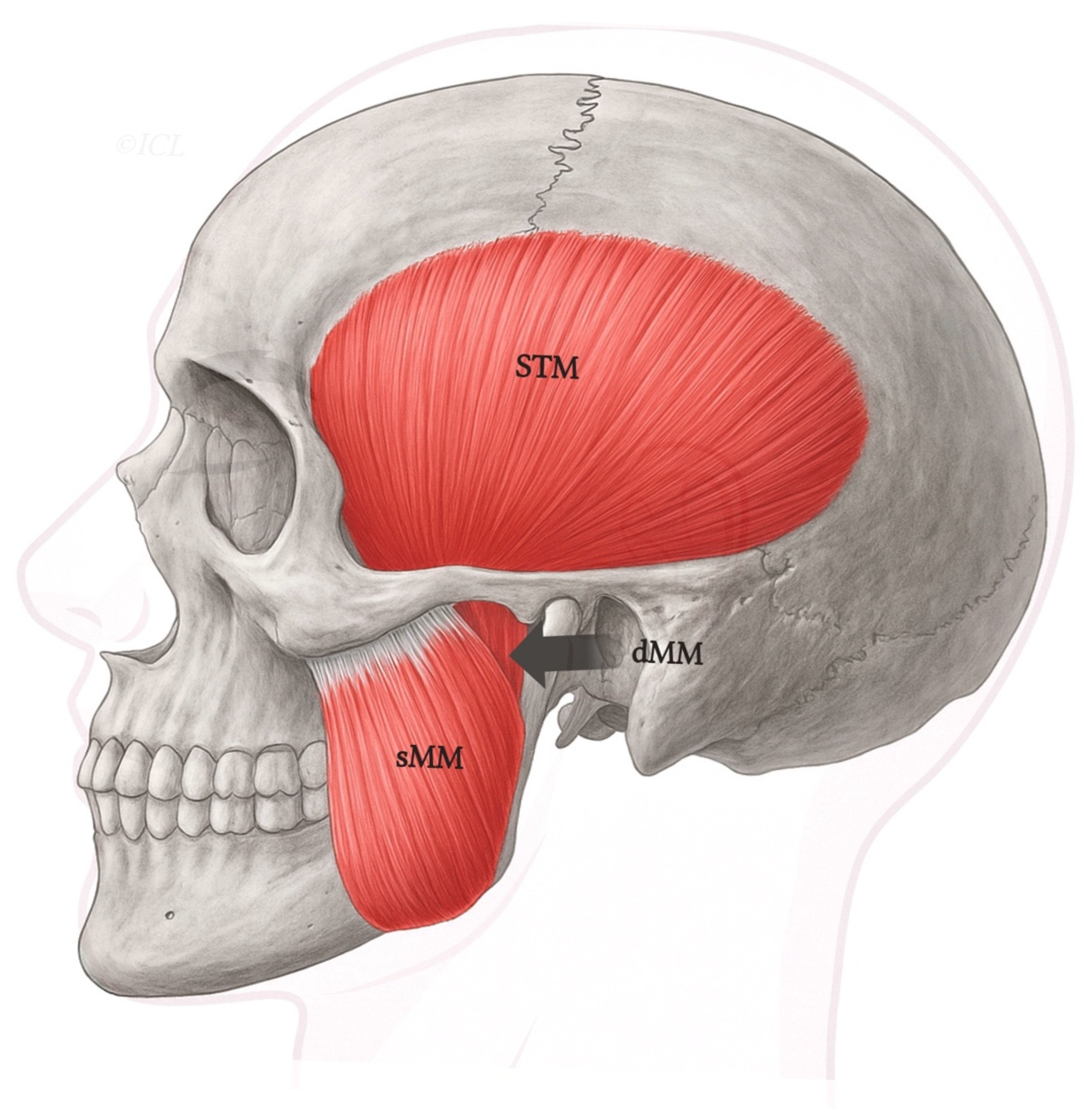 The Deep Head Of The Masseter Muscle A Classification Based Anatomical The Deep Head Of The Masseter Muscle A Classification Based Anatomical