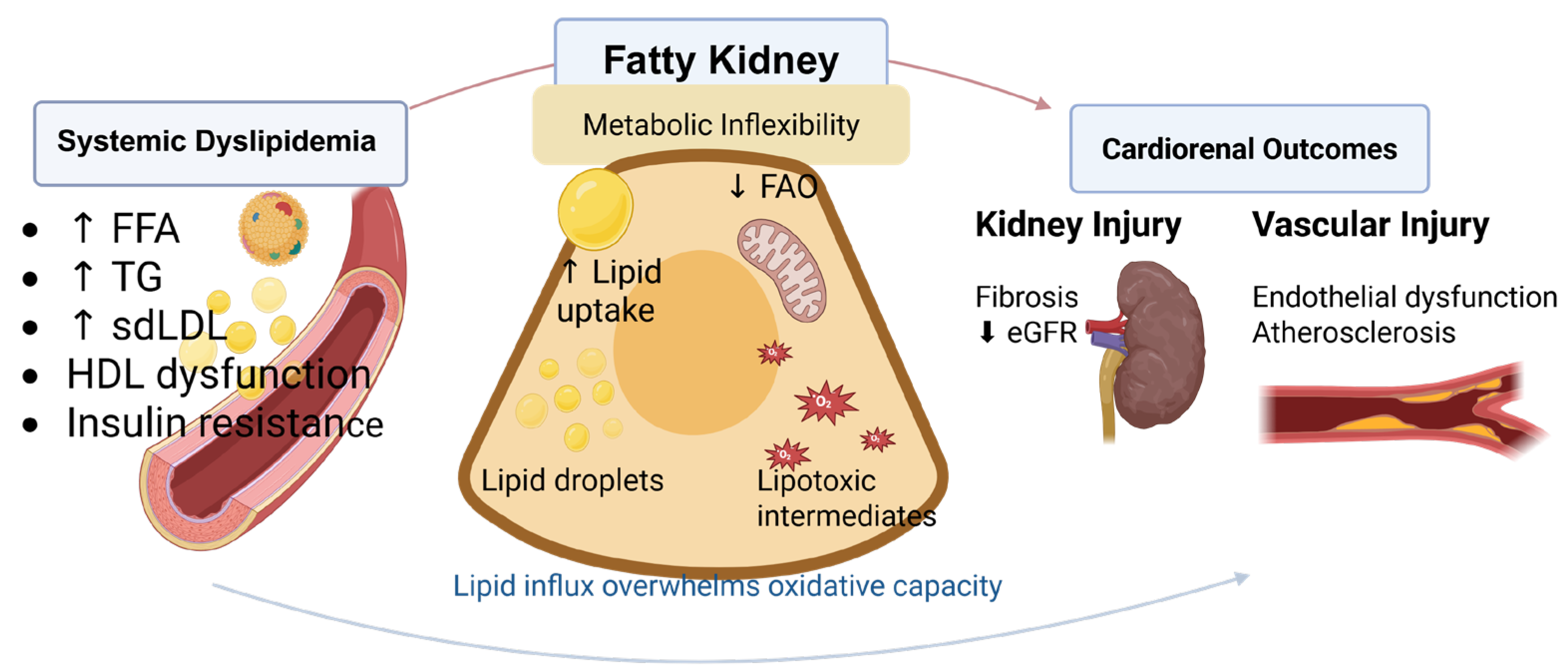 Fatty Kidney: The Interplay of Lipids and Diabetic Kidney Disease