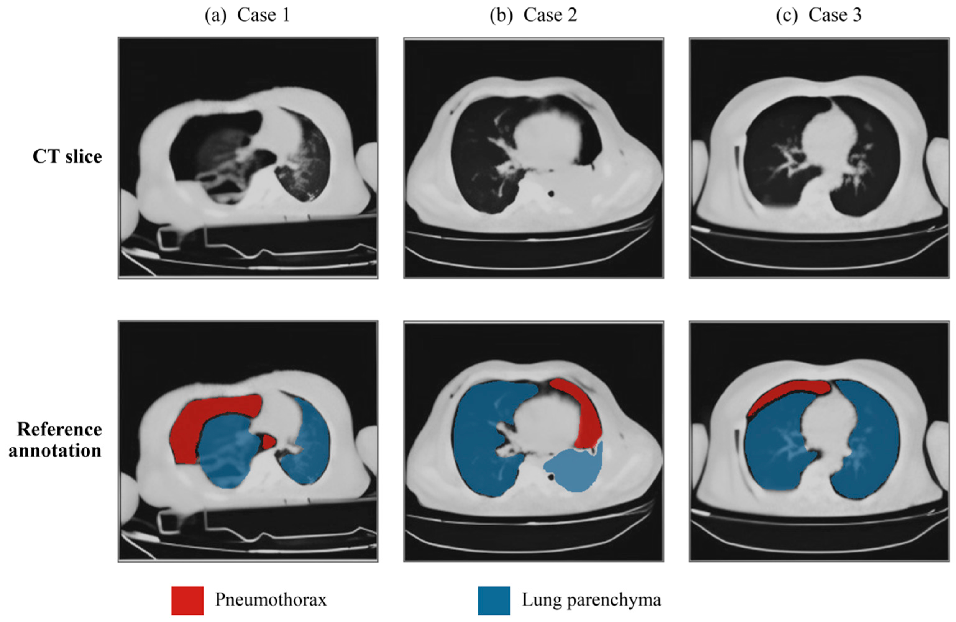 A SAM2 and VLM-Based Automatic Radiological Reporting System for ...