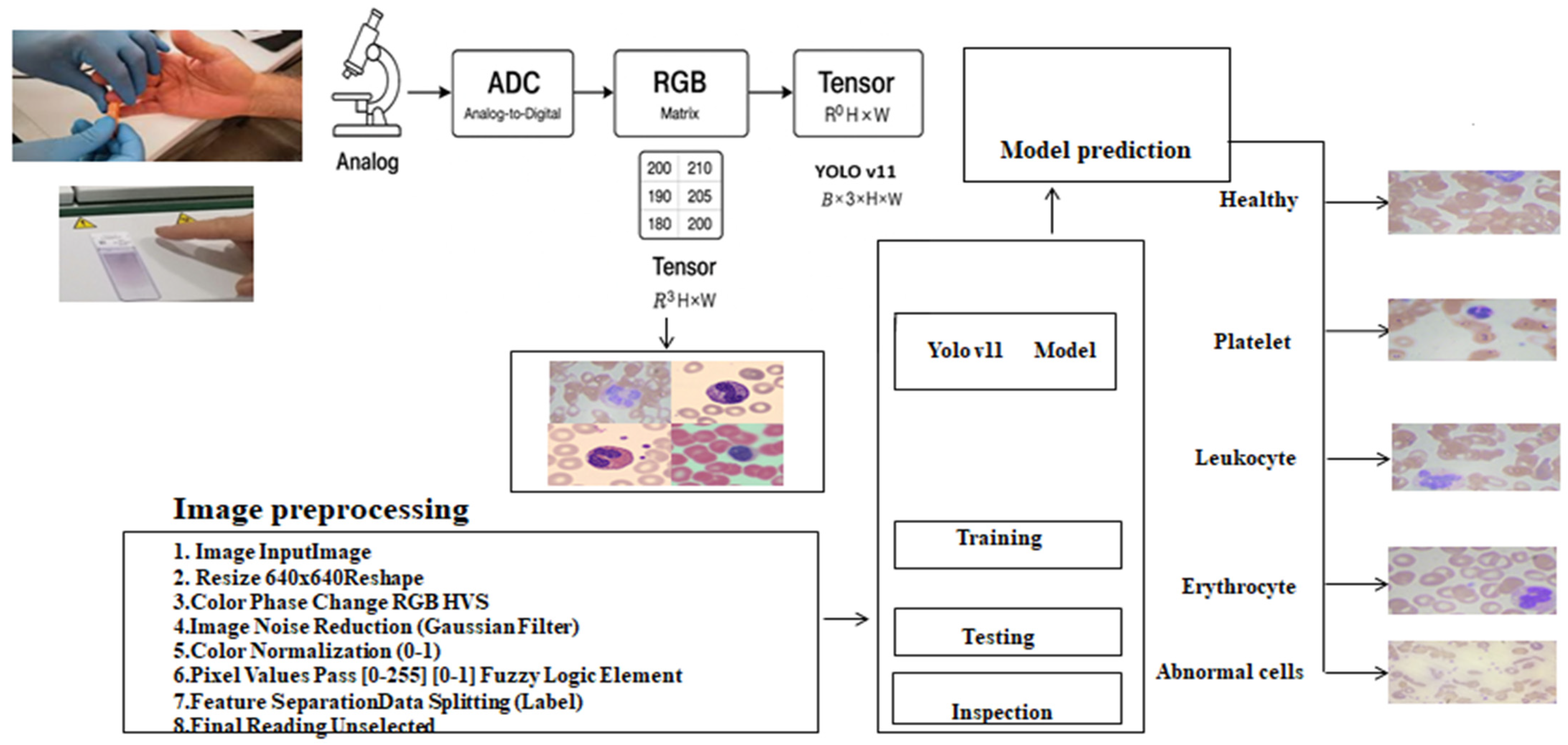 Early Diagnosis of Blood Disorders via Enhanced Image Preprocessing and ...