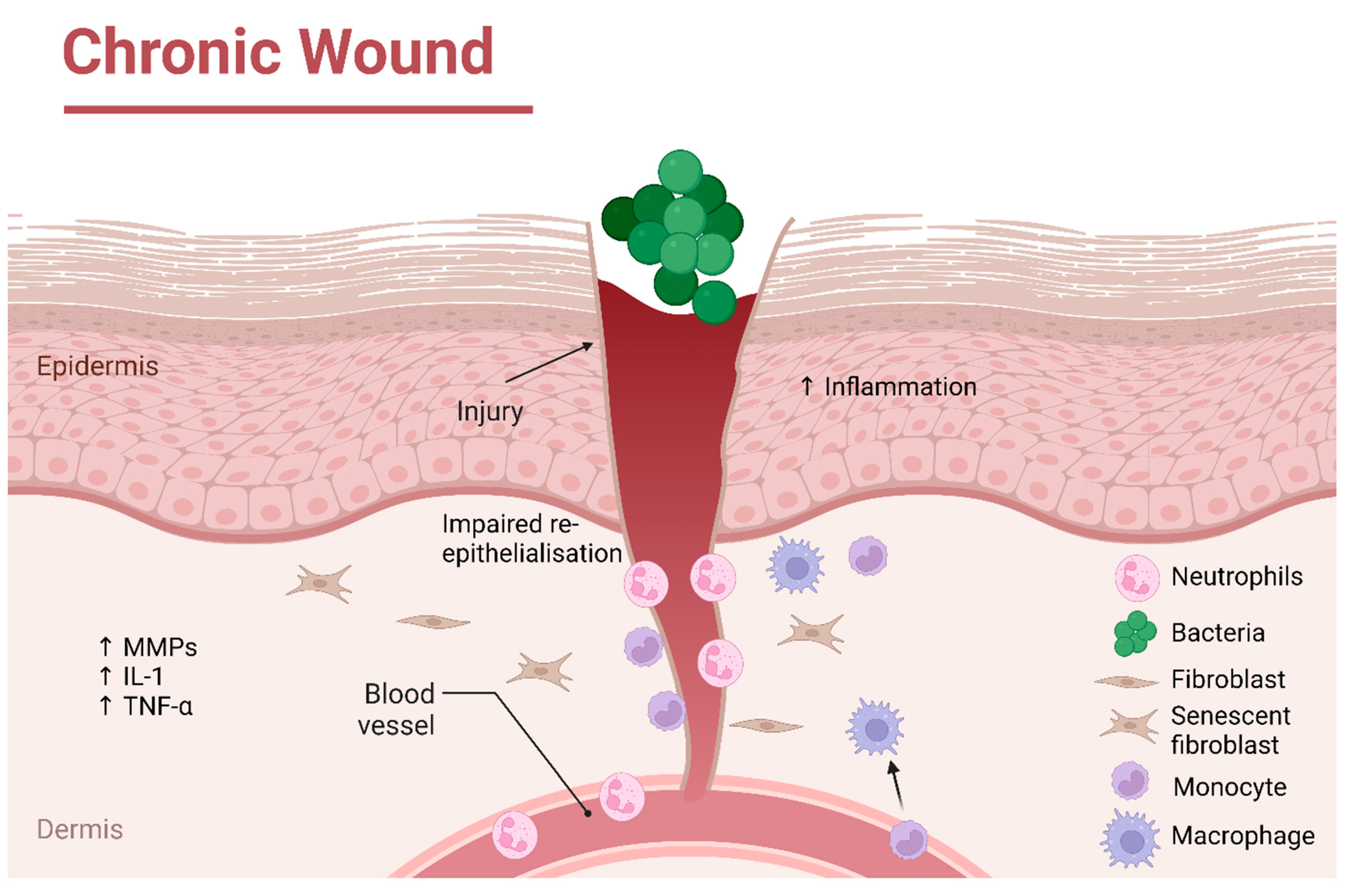 Pycnogenol and wound healing