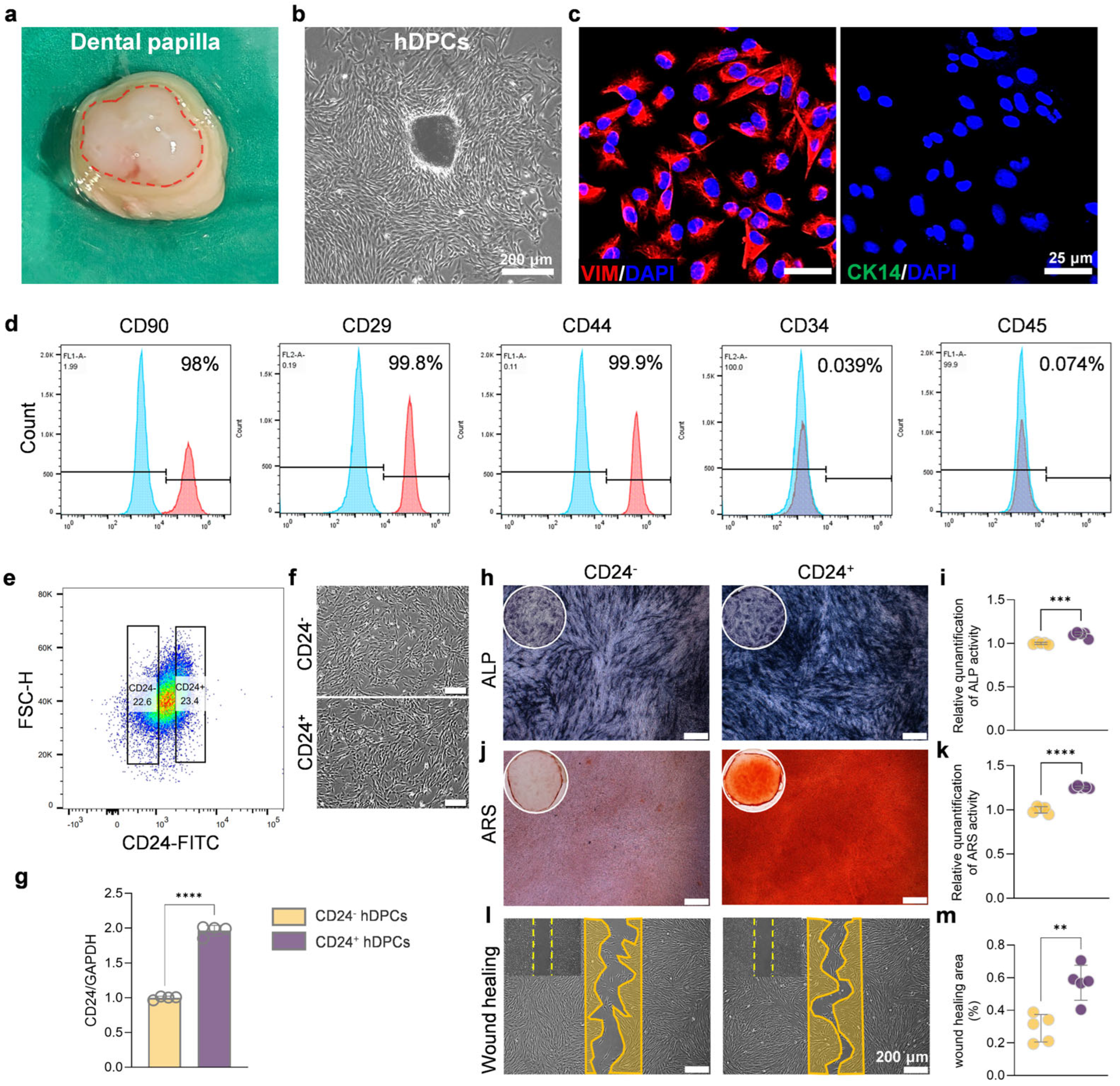 Extracellular Vesicles Derived from Human CD24+ Dental Papilla Stem ...