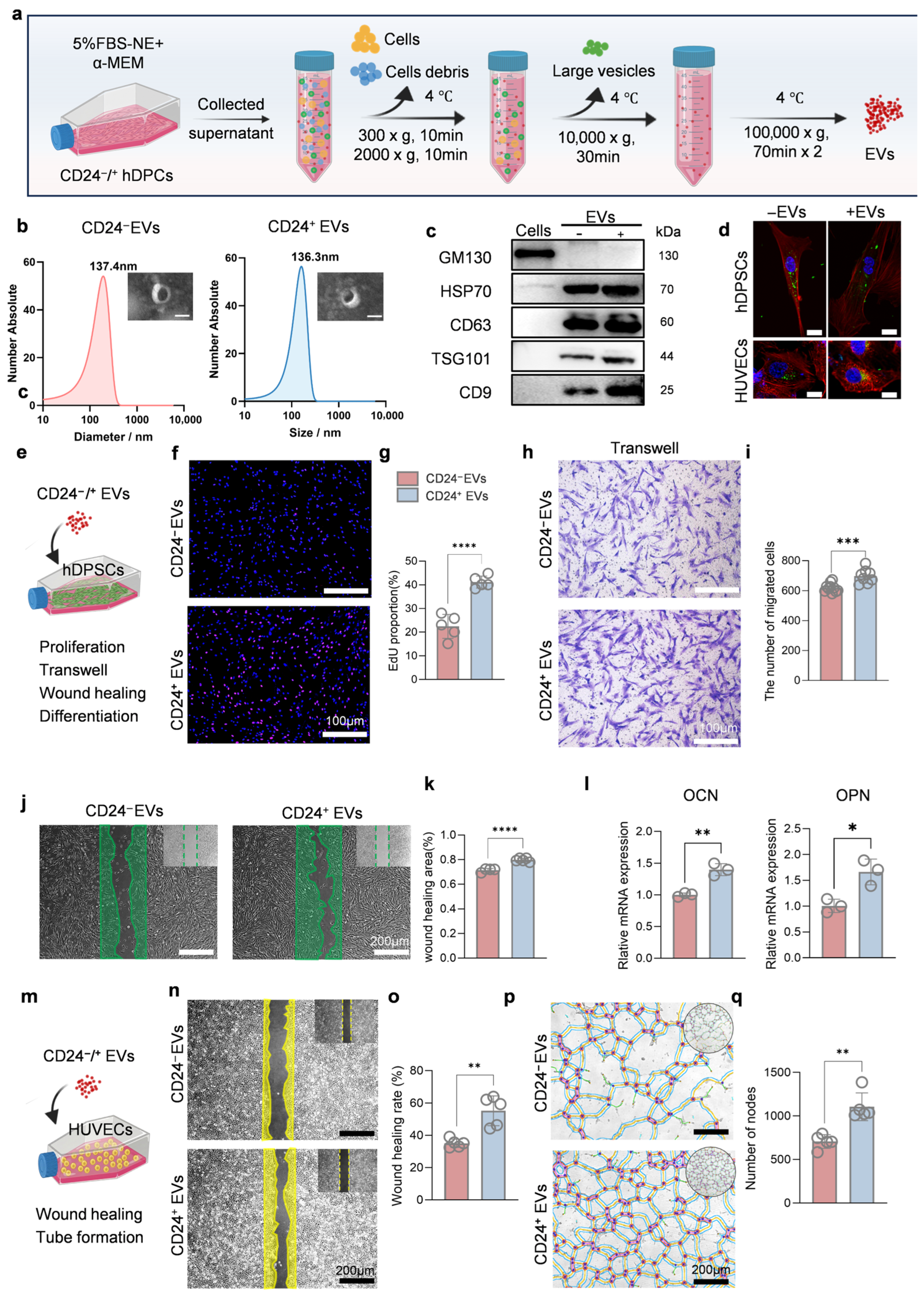 Extracellular Vesicles Derived from Human CD24+ Dental Papilla Stem ...