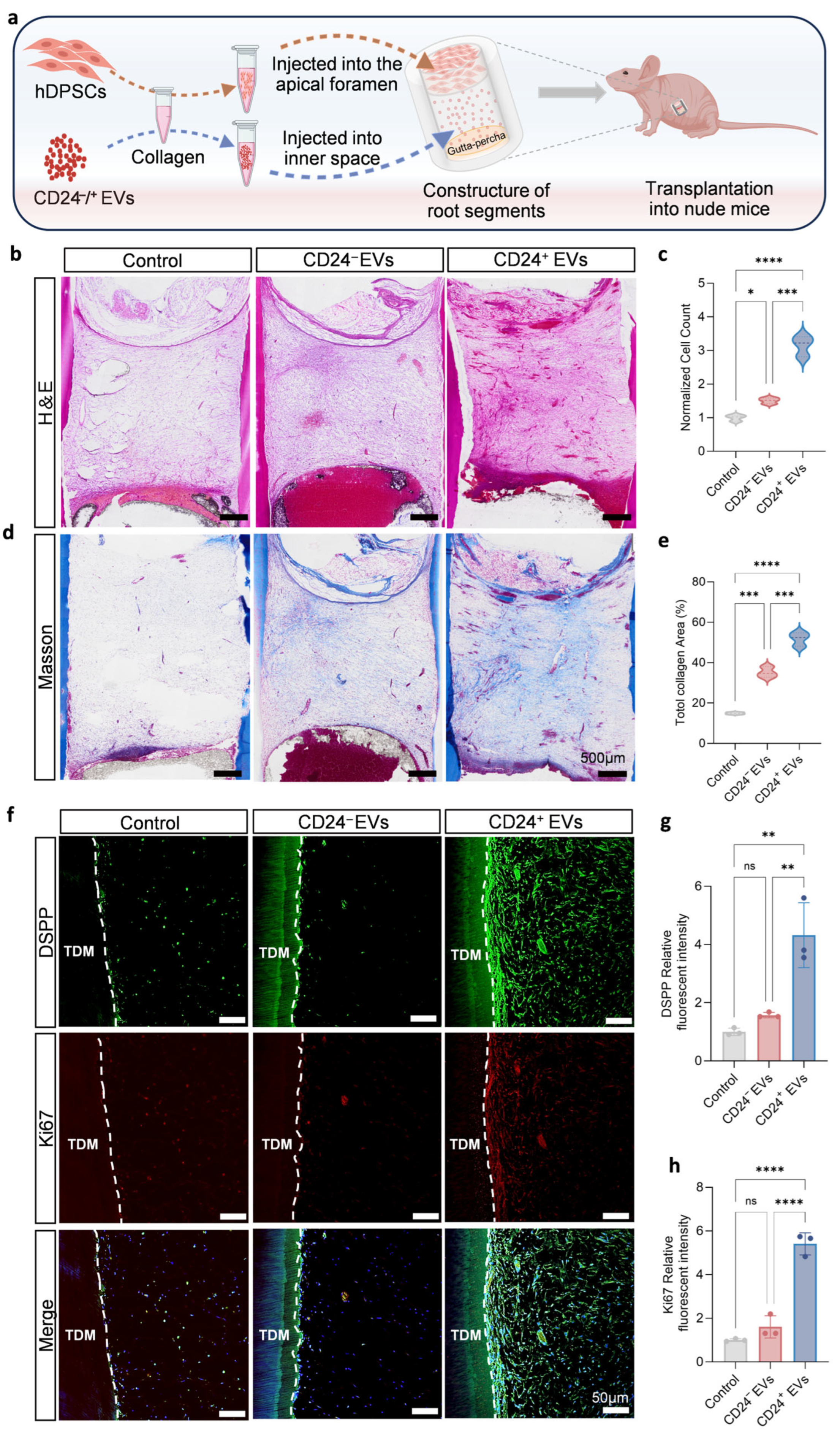 Extracellular Vesicles Derived from Human CD24+ Dental Papilla Stem ...