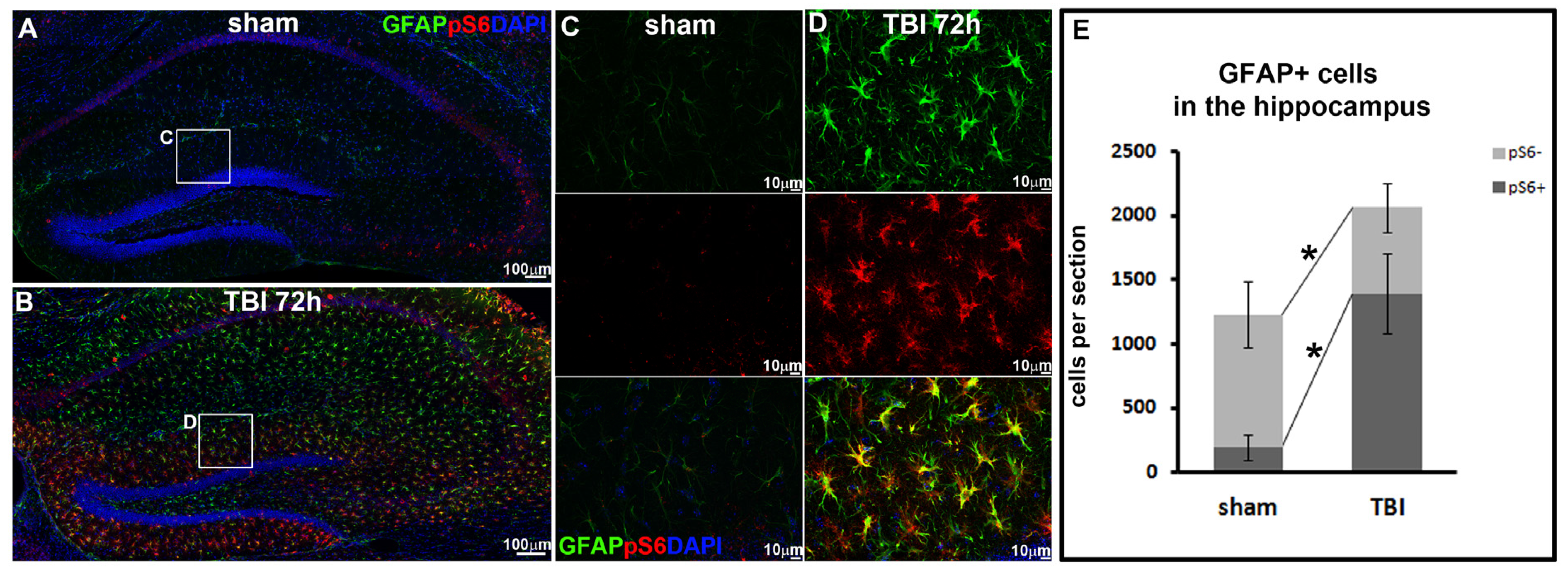 mTOR Activation Is Required for the Proliferation of Reactive ...