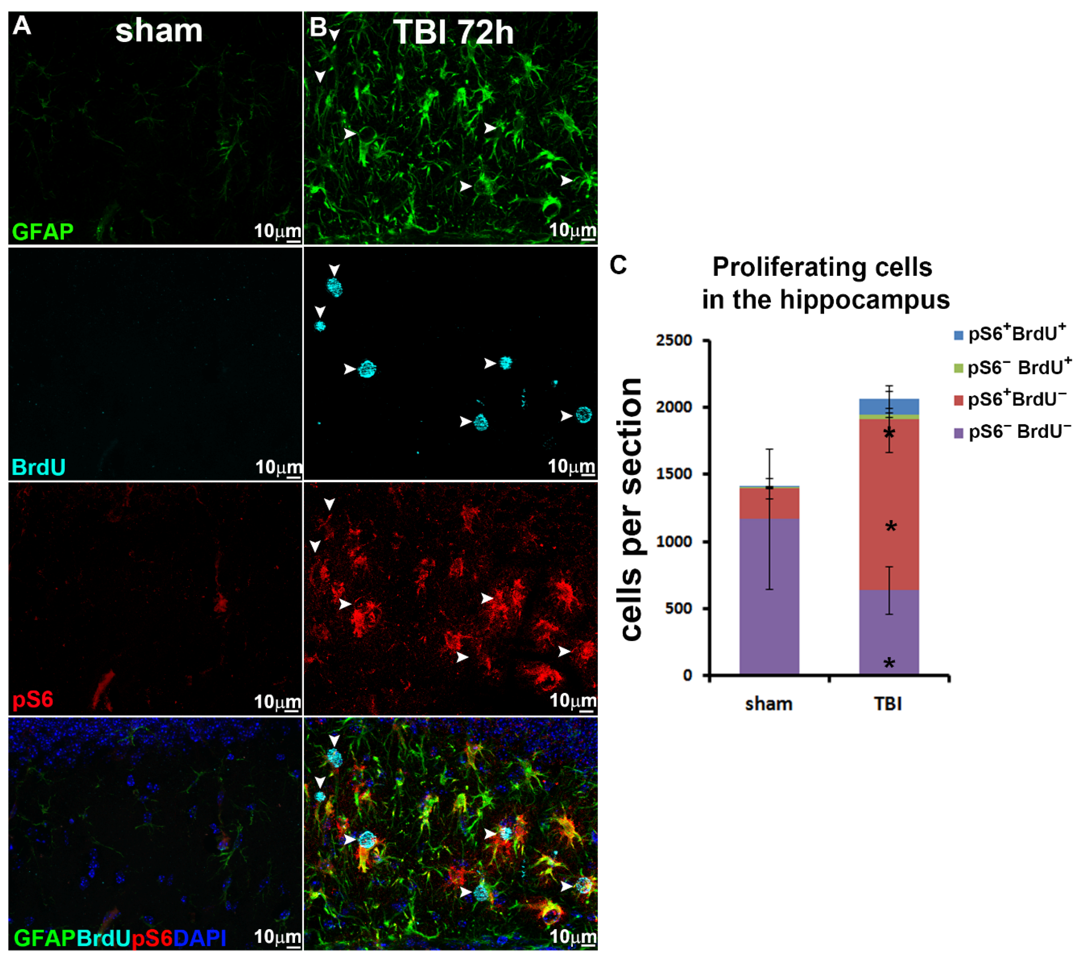 mTOR Activation Is Required for the Proliferation of Reactive ...