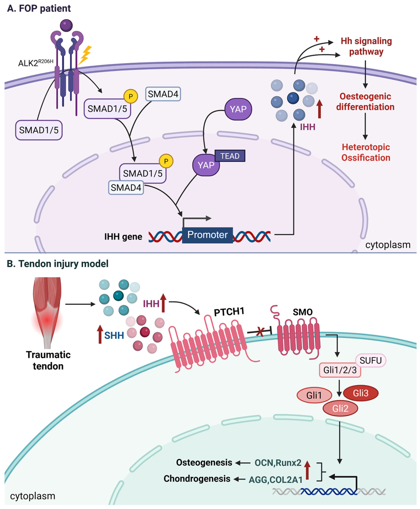 Fop Pathogenesis Heterotopic Ossification: Molecular Drivers, Subtype-Specific ...