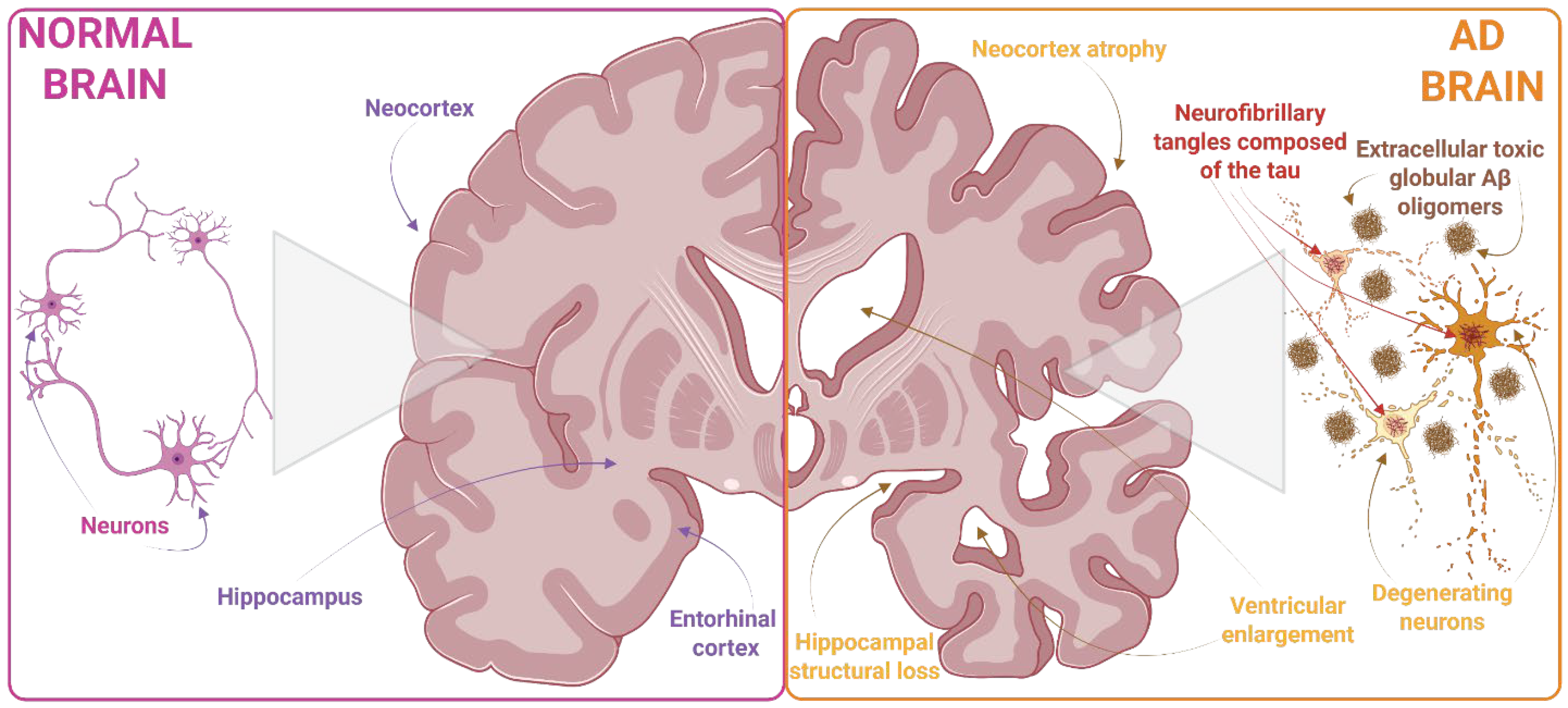 Tau and β-Amyloid Relevant Pathology as a Central Therapeutic Target in ...
