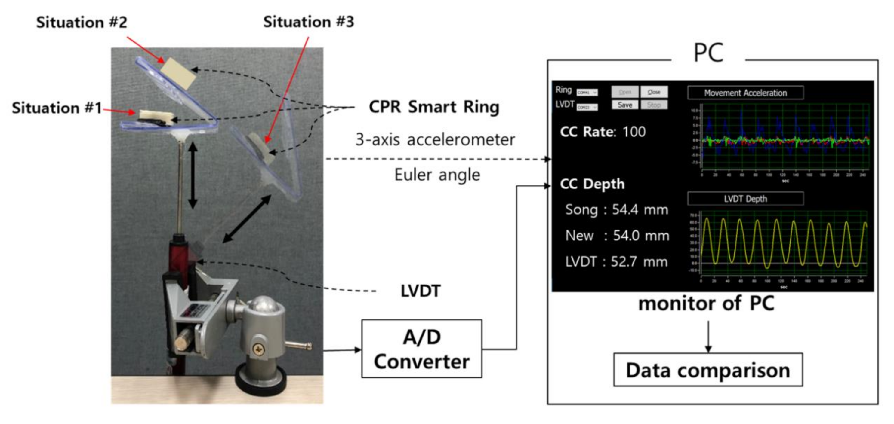 A novel depth estimation algorithm of chest compression for feedback of  high-quality cardiopulmonary resuscitation based on a smartwatch -  ScienceDirect