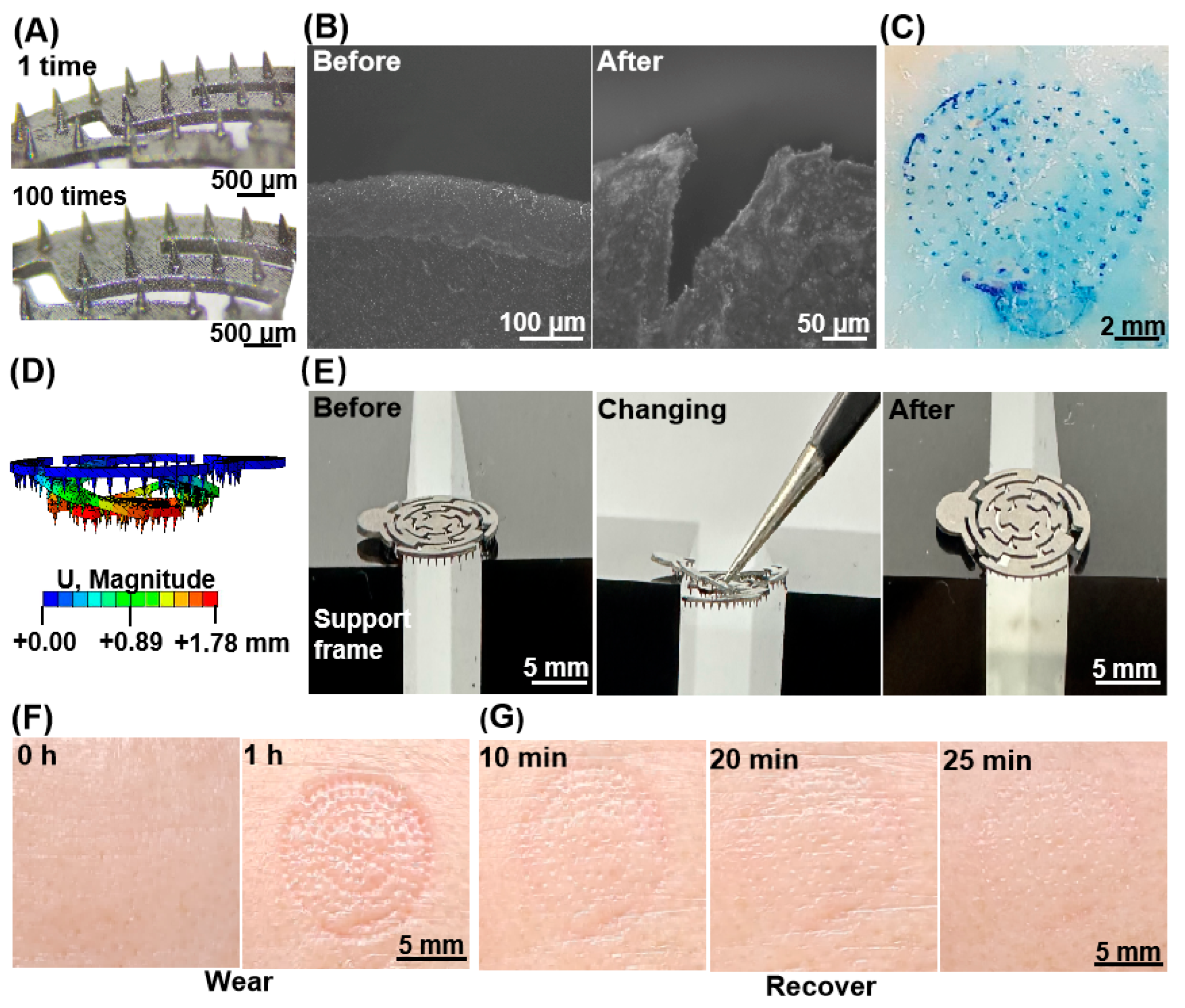 Development of a Flexible Microneedle Array Electrode with a High ...