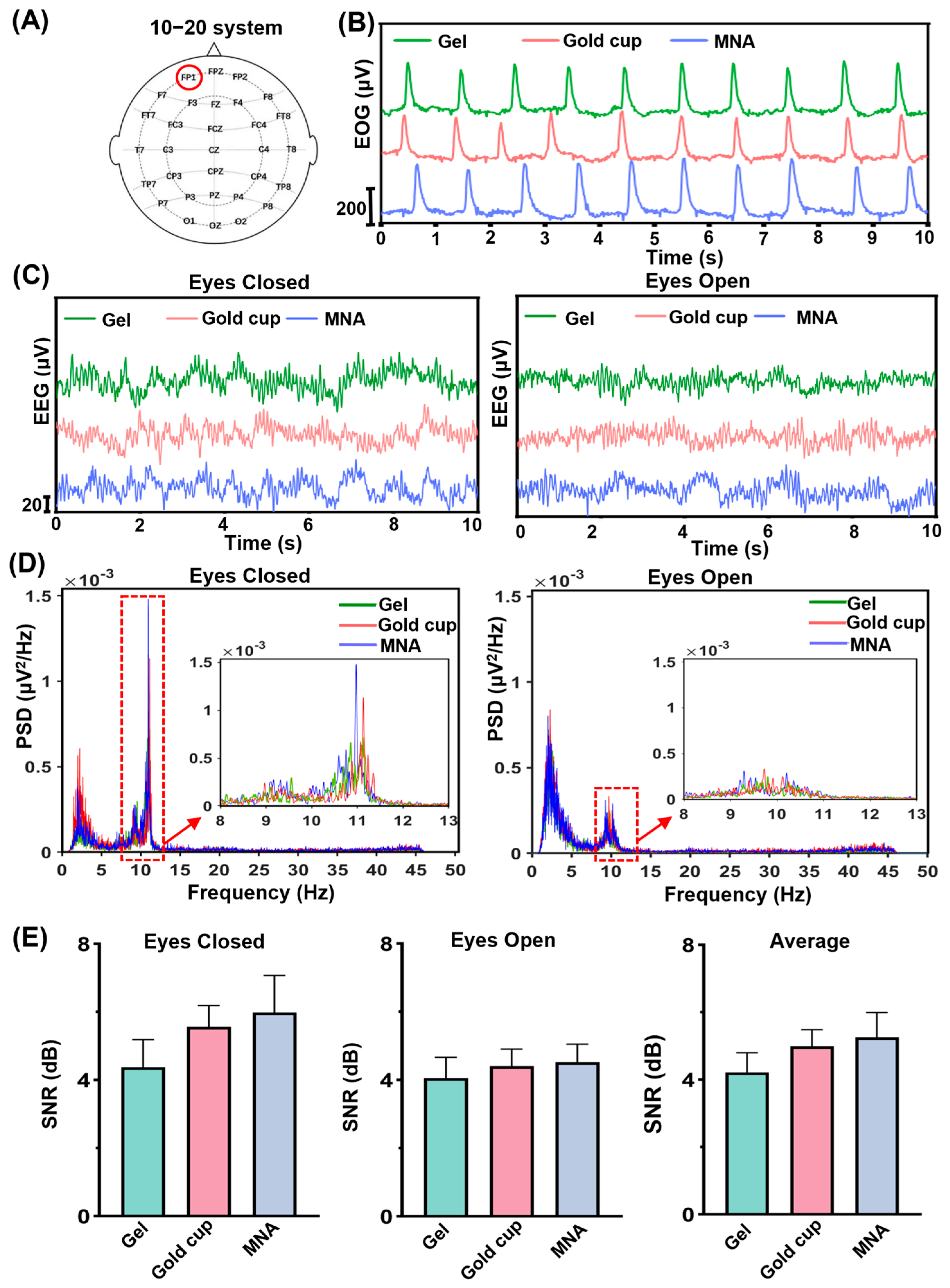 Development of a Flexible Microneedle Array Electrode with a High ...