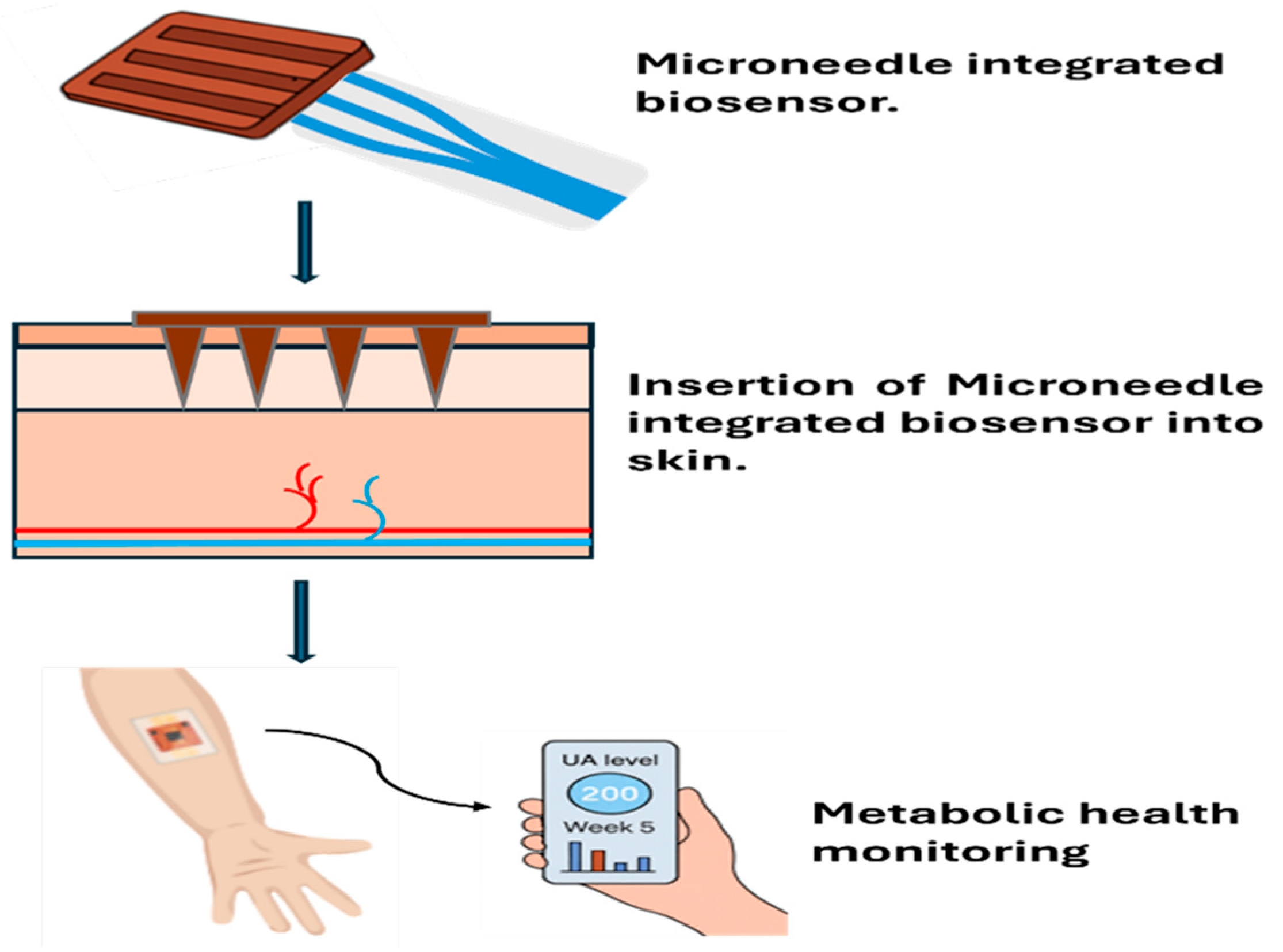 Biosensor-Integrated Microneedle Devices for Diagnosis and Treatment of ...