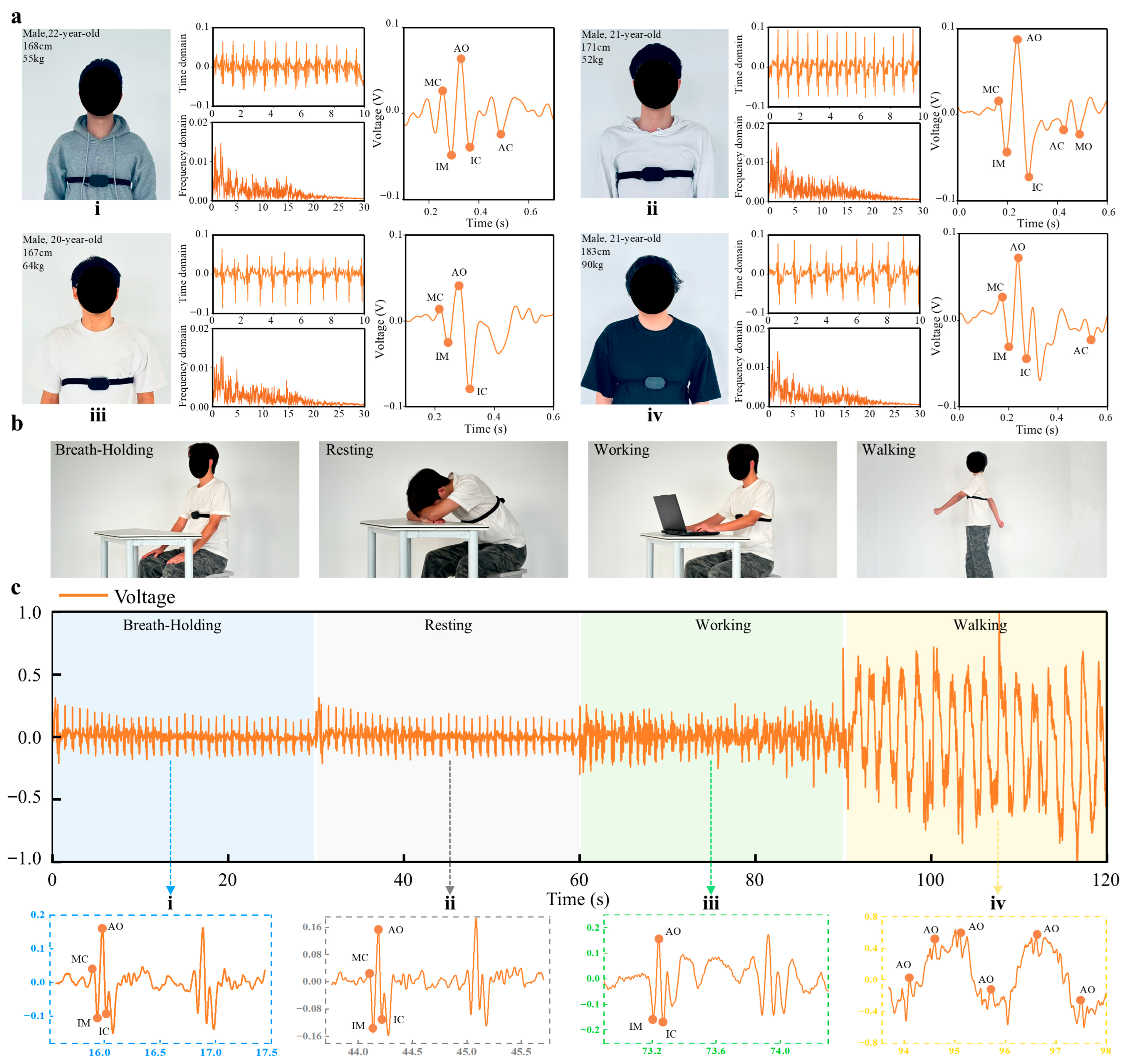 A Flexible Triboelectric-Based Sensor for Seismocardiography Monitoring