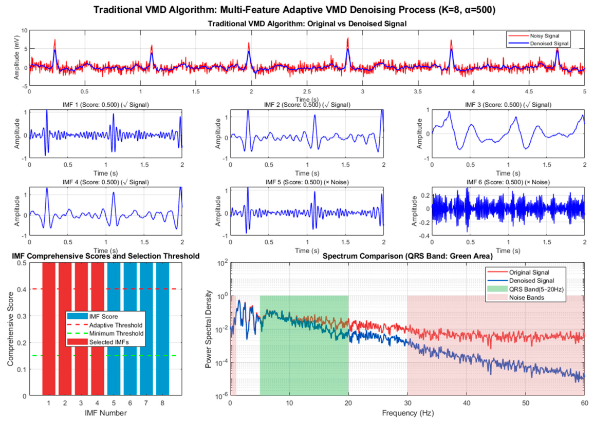 Multi-Feature Adaptive Variational Mode Decomposition for Wearable ECG ...