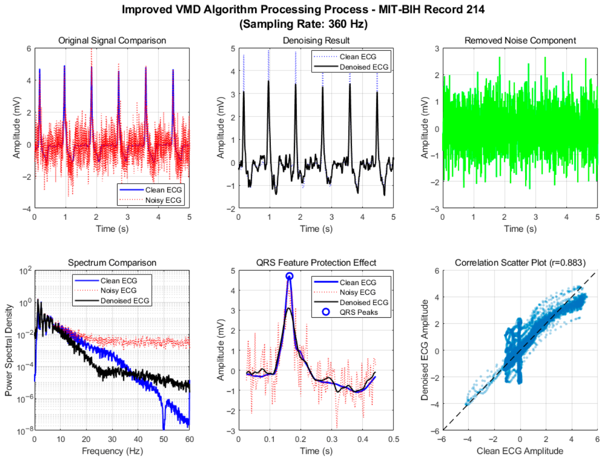 Multi-Feature Adaptive Variational Mode Decomposition for Wearable ECG ...