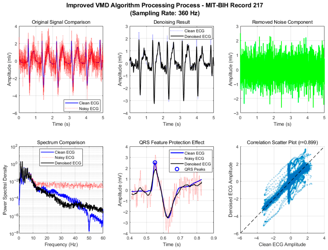 Multi-Feature Adaptive Variational Mode Decomposition for Wearable ECG ...