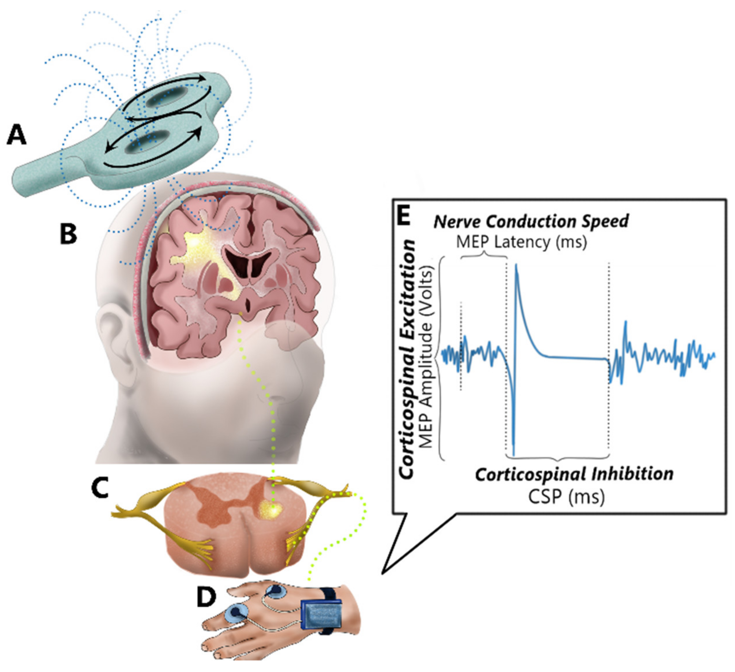 Brain Sciences | Free | Probing the Brain–Body Using Transcranial Magnetic Stimulation (TMS): Validating a Promising Tool to Provide Biomarkers of Neuroplasticity and Central Nervous System Function