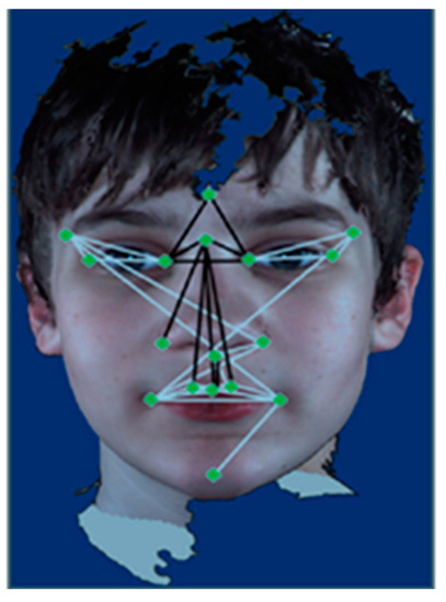 Brain Sciences | Free Full-Text | Deep Learning Approach for Screening  Autism Spectrum Disorder in Children with Facial Images and Analysis of  Ethnoracial Factors in Model Development and Application