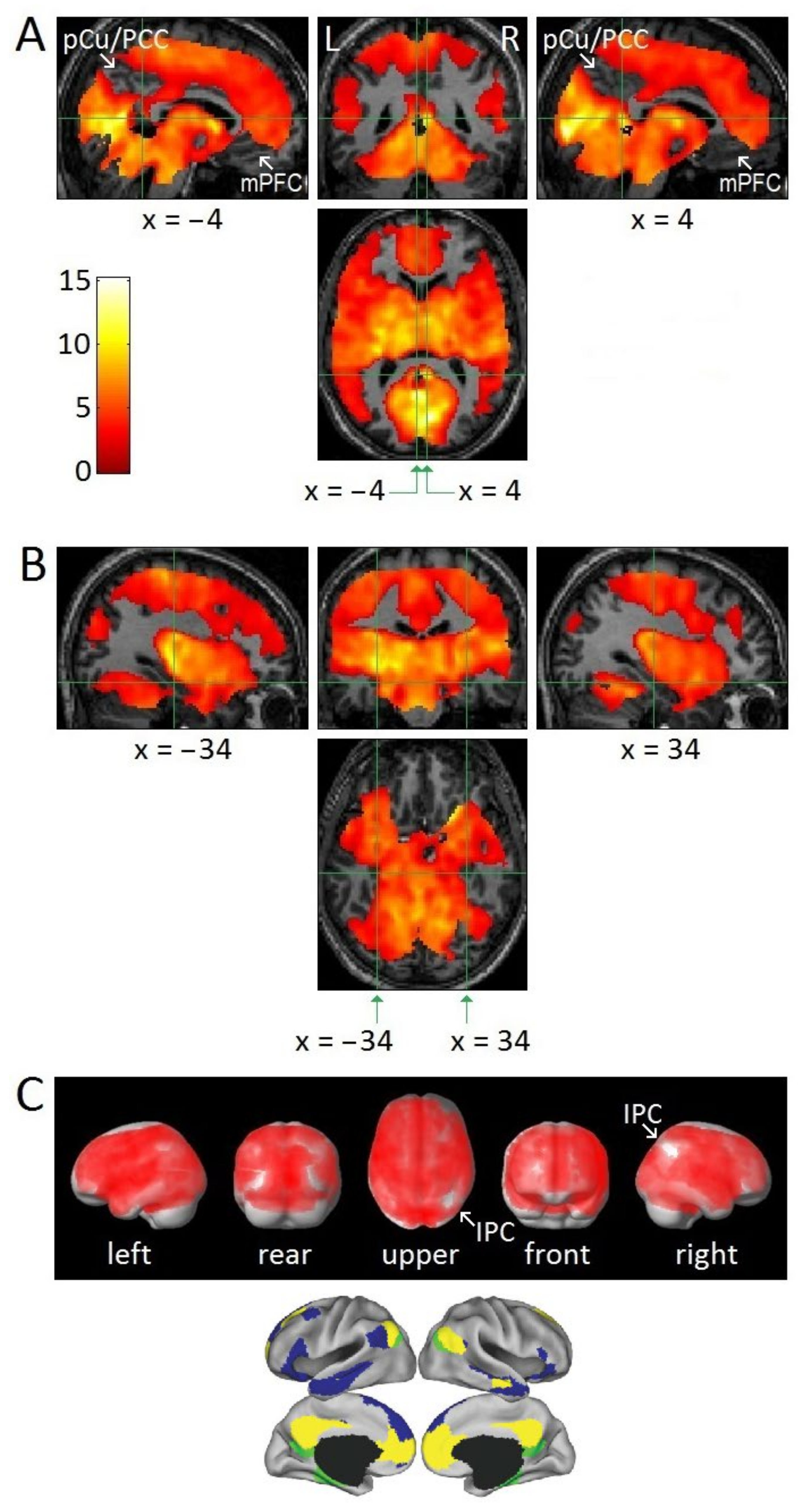 Leigh Allyn Baker Shemale Porn - Brain Sciences | Free Full-Text | fMRI Evidence for Default Mode Network  Deactivation Associated with Rapid Eye Movements in Sleep