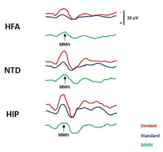 Brain Sciences | Free Full-Text | High Intellectual Potential and High  Functioning Autism: Clinical and Neurophysiological Features in a Pediatric  Sample