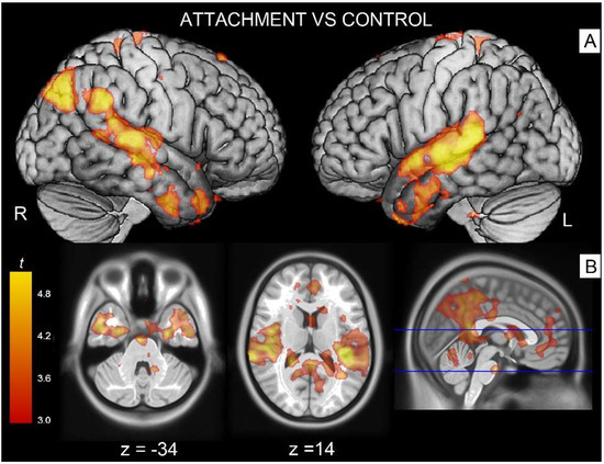 Brain Sciences | Special Issue : State of the Art in Human Attachment