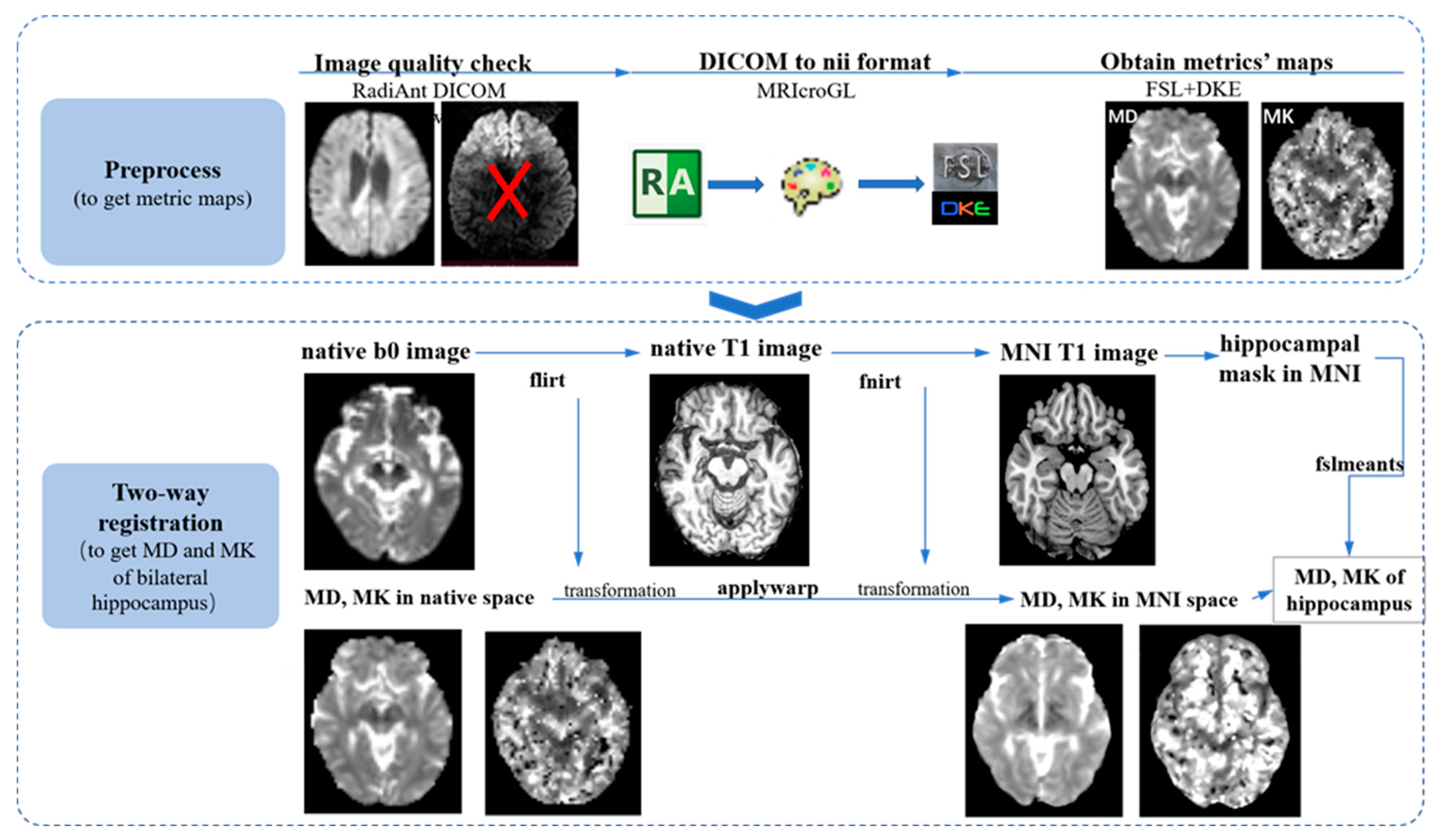 Brain Sciences | Free Full-Text | The Use of Diffusion Kurtosis Imaging ...