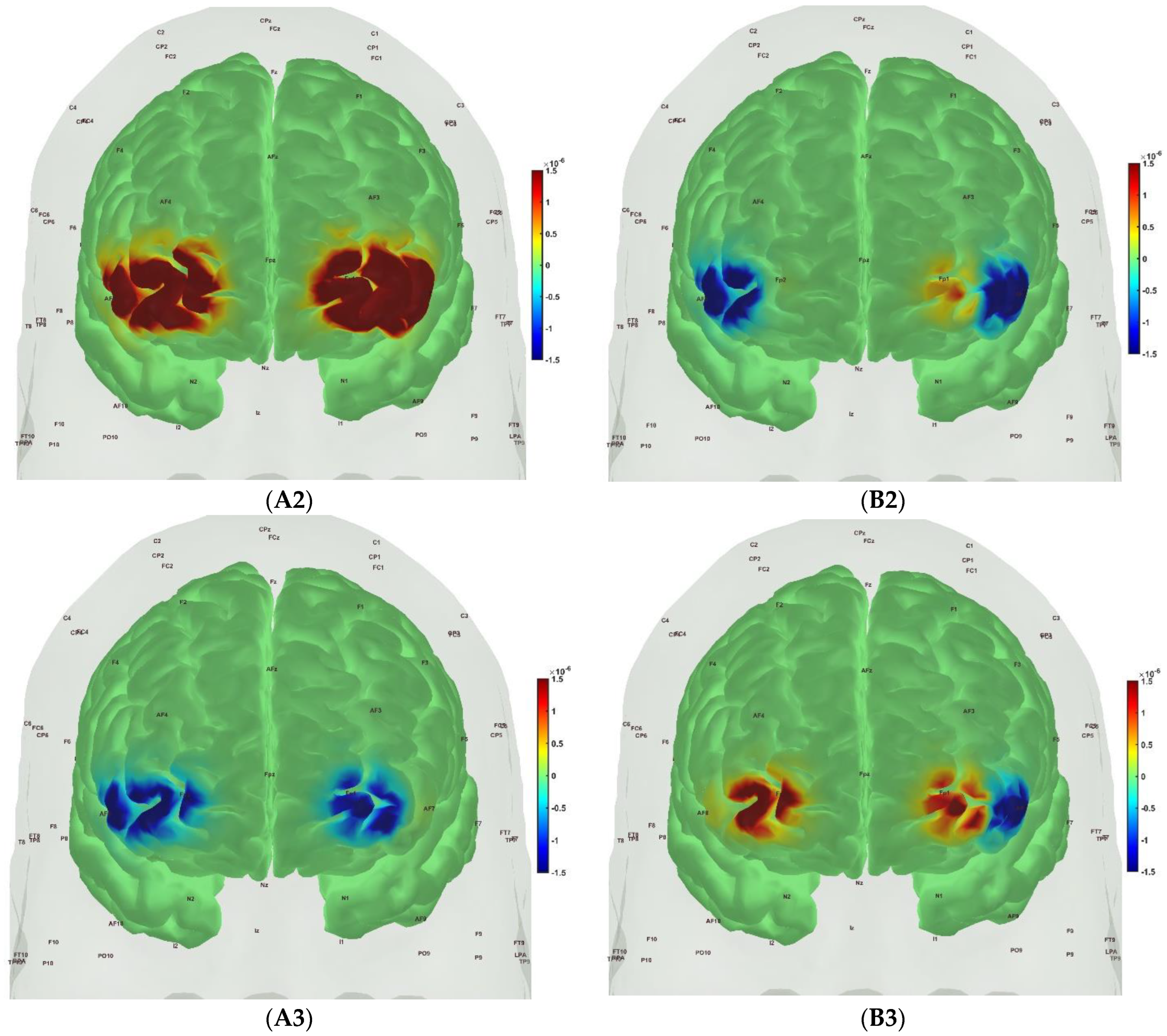 Brain Sciences | Free Full-Text | Operational Modal Analysis of 