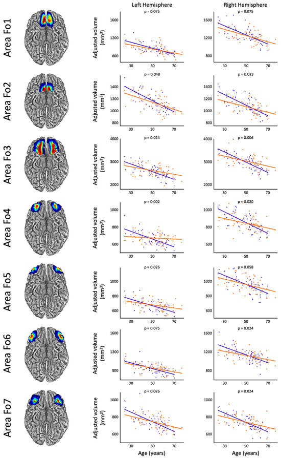 Brain Sciences | Free Full-Text | Reduced Age-Related Gray Matter Loss ...