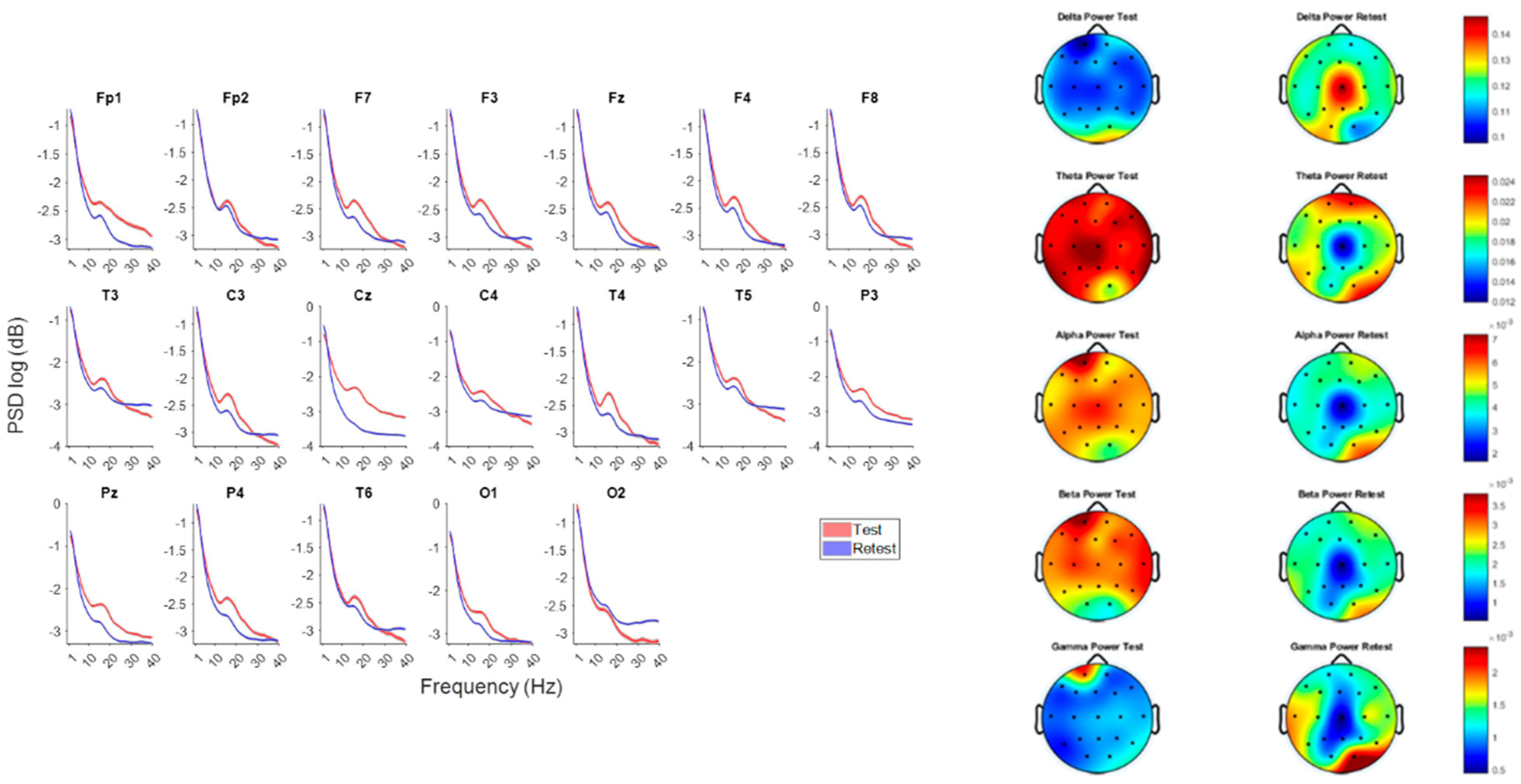 Mixed-Frequency rTMS Rapidly Modulates Multiscale EEG Biomarkers of ...
