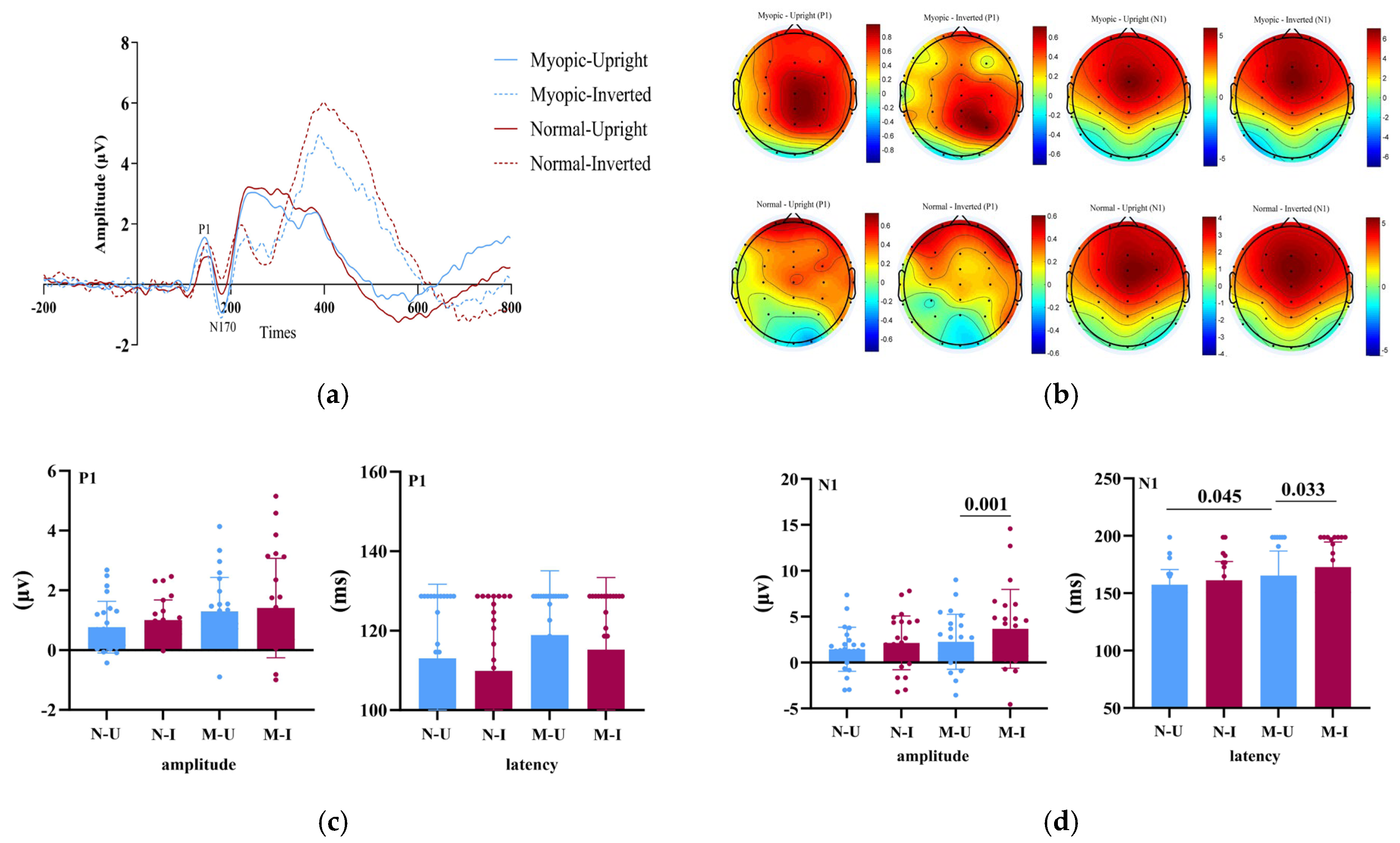 Visual Neural Dynamics of Adolescents with Myopia During Face Inversion ...