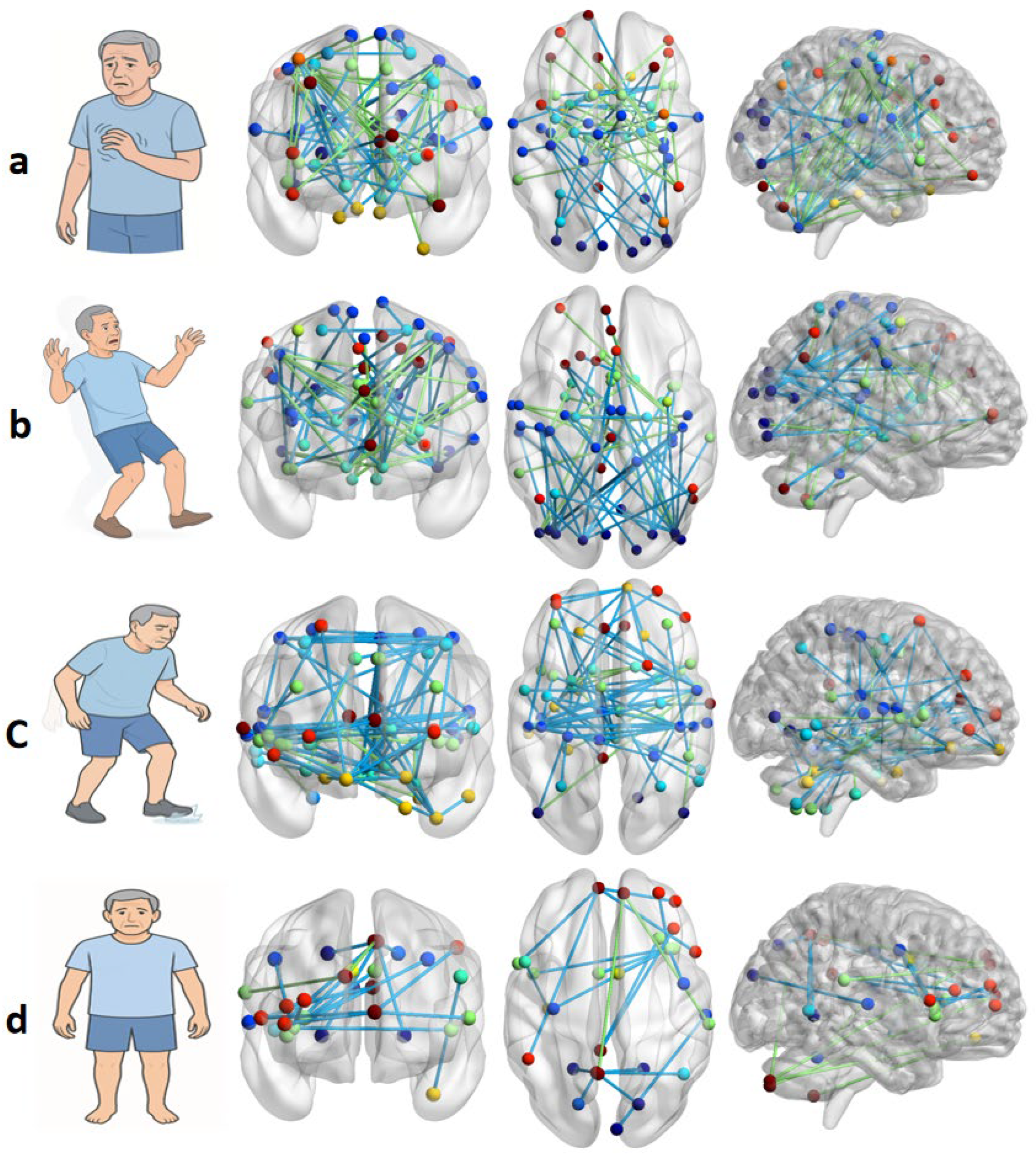 Symptom-Specific Networks and the DBS-Modulated Network in Parkinson’s ...