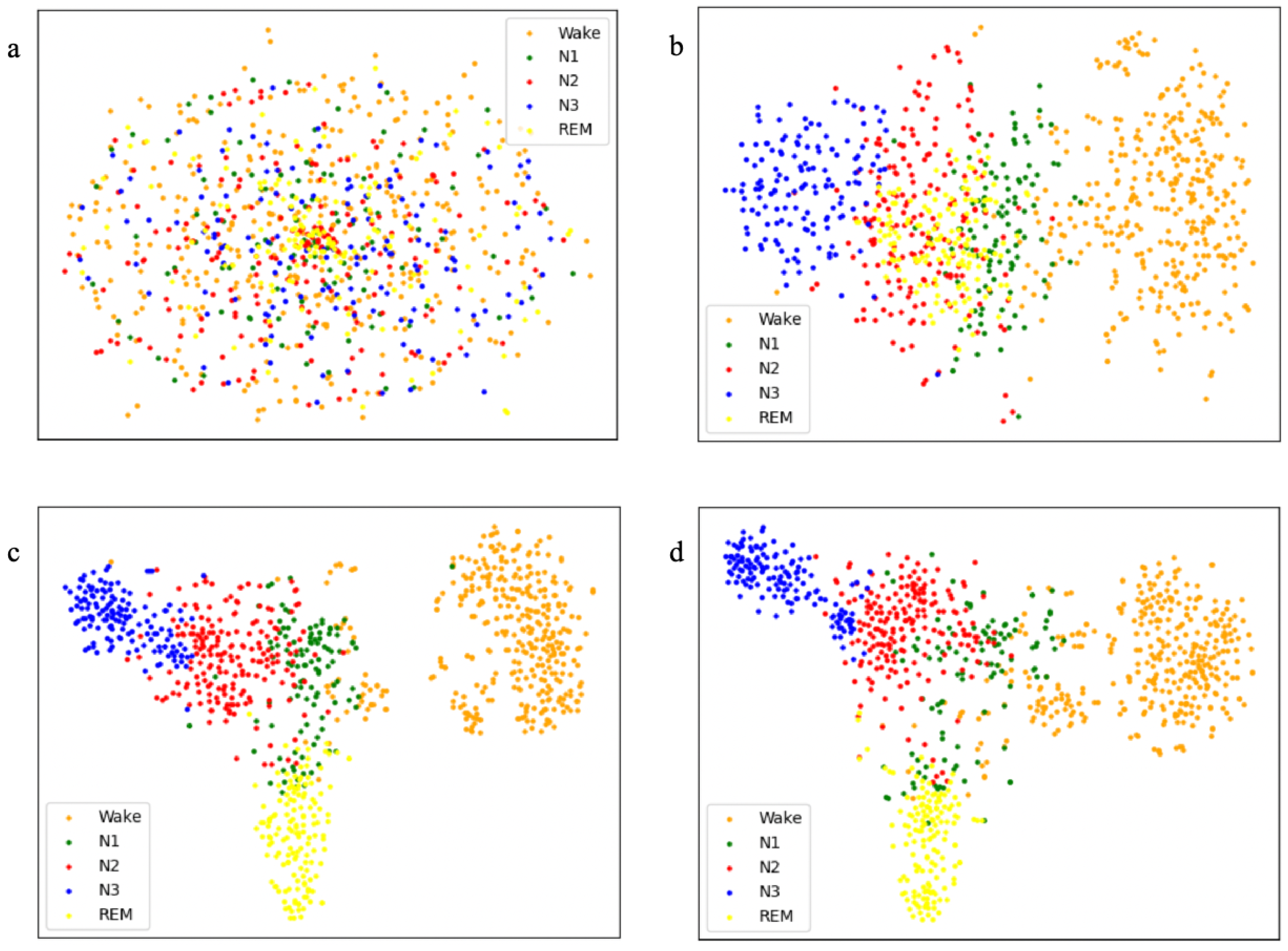 MFST-GCN: A Sleep Stage Classification Method Based on Multi-Feature ...