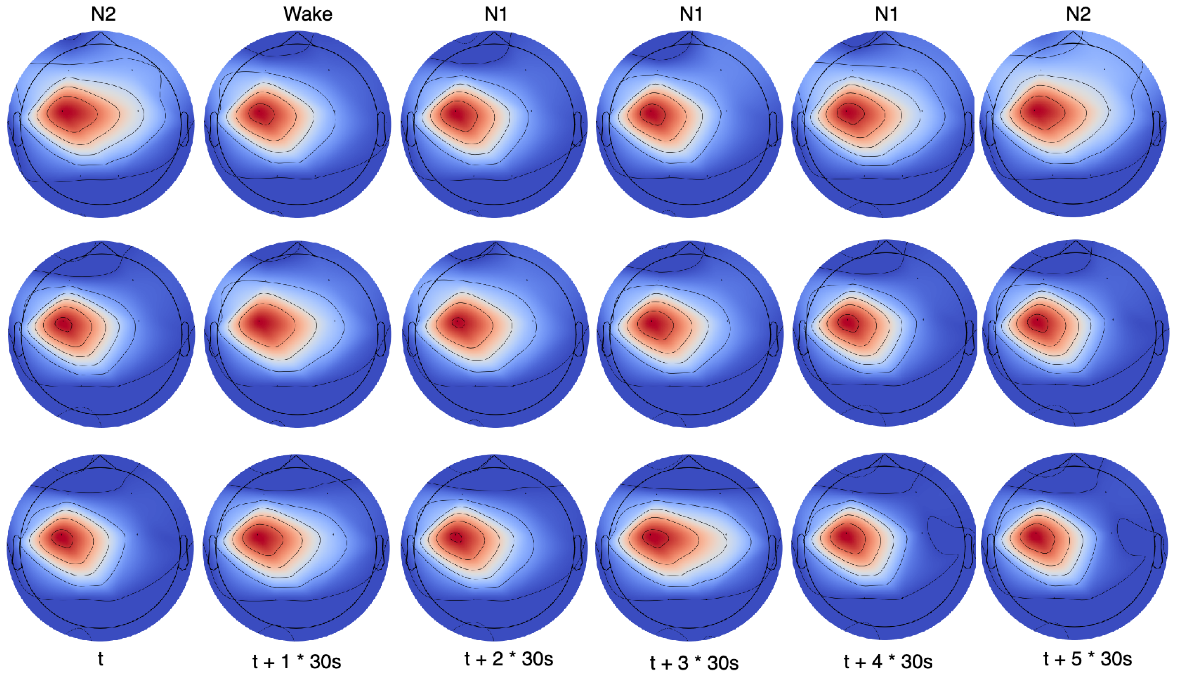 MFST-GCN: A Sleep Stage Classification Method Based on Multi-Feature ...