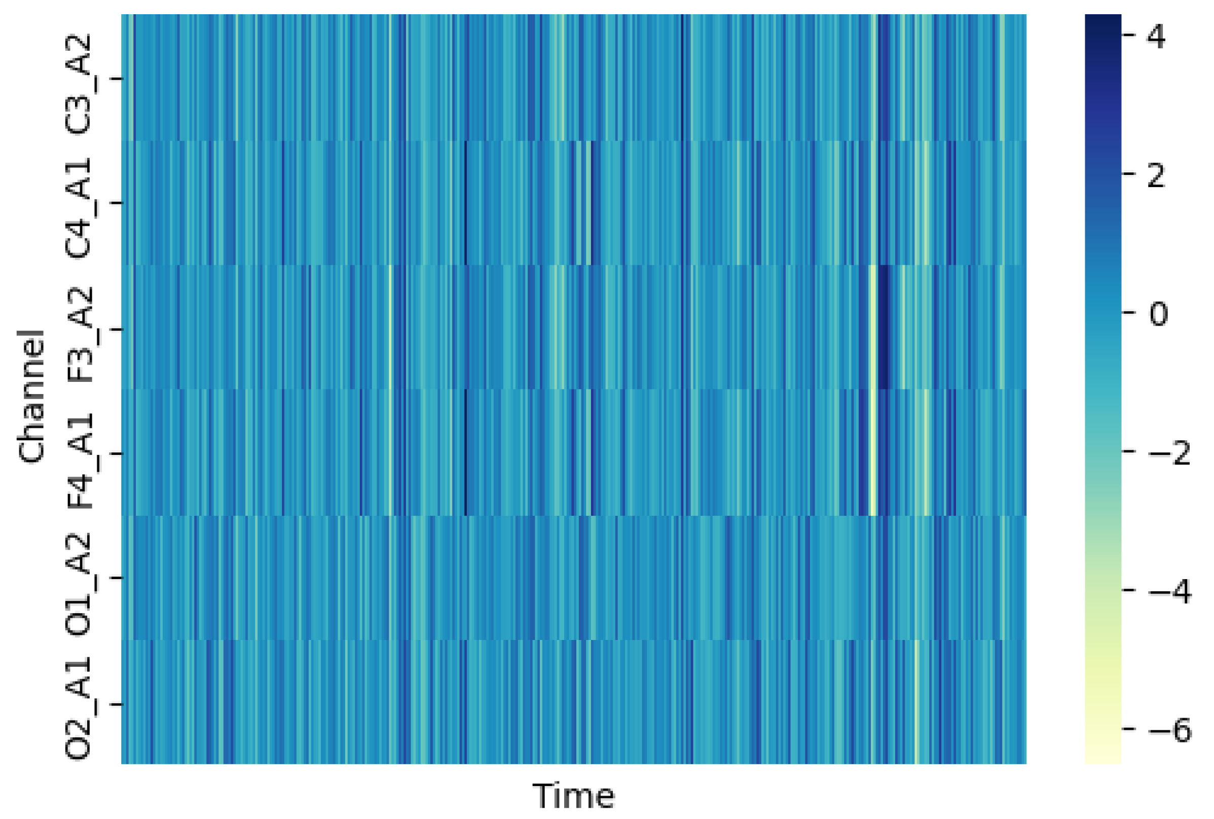 MFST-GCN: A Sleep Stage Classification Method Based on Multi-Feature ...