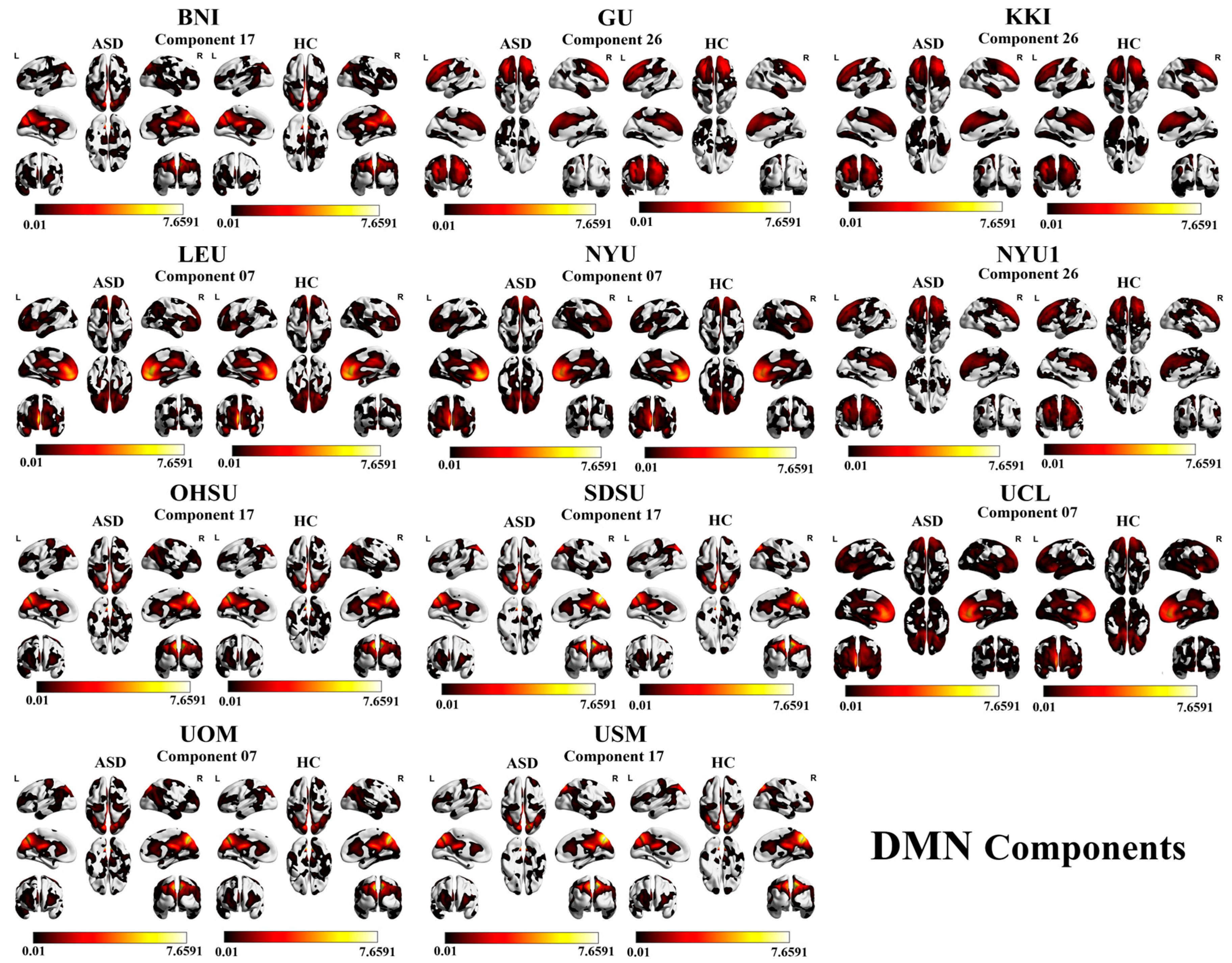 Multi-Site Classification of Autism Spectrum Disorder Using Spatially ...