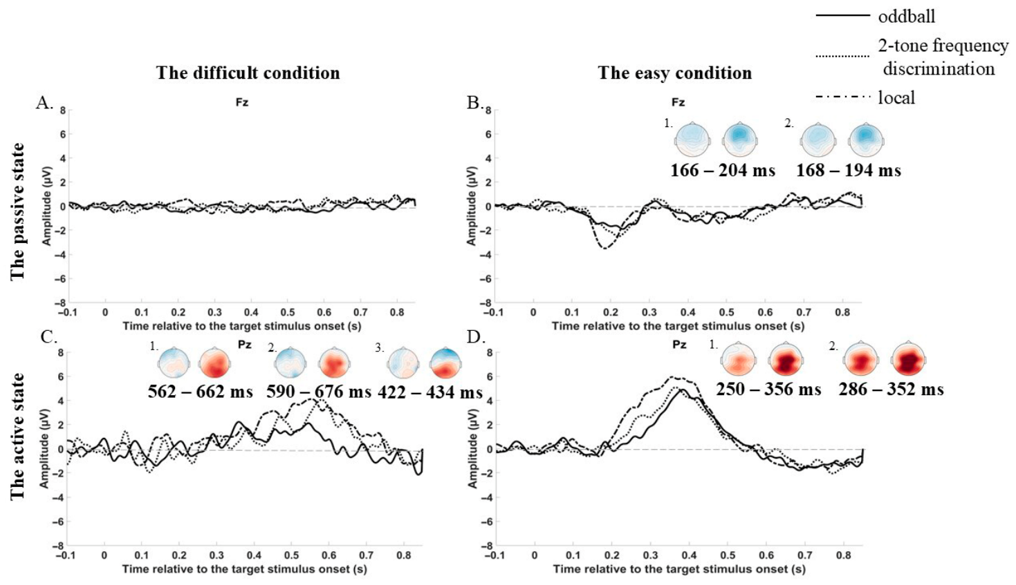Does Sound Timing Organization Matter? How Time Interval Influences the ...