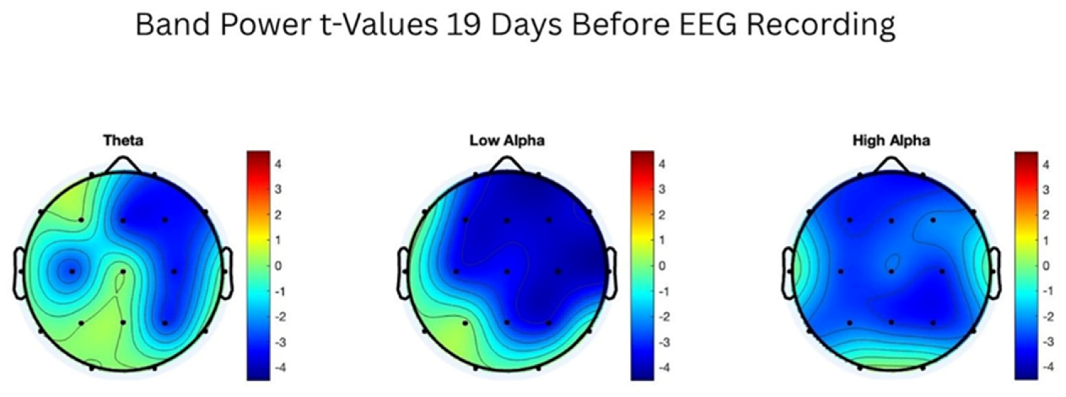 Delayed Correlations Between Geomagnetic Activity and Human EEG Alpha ...