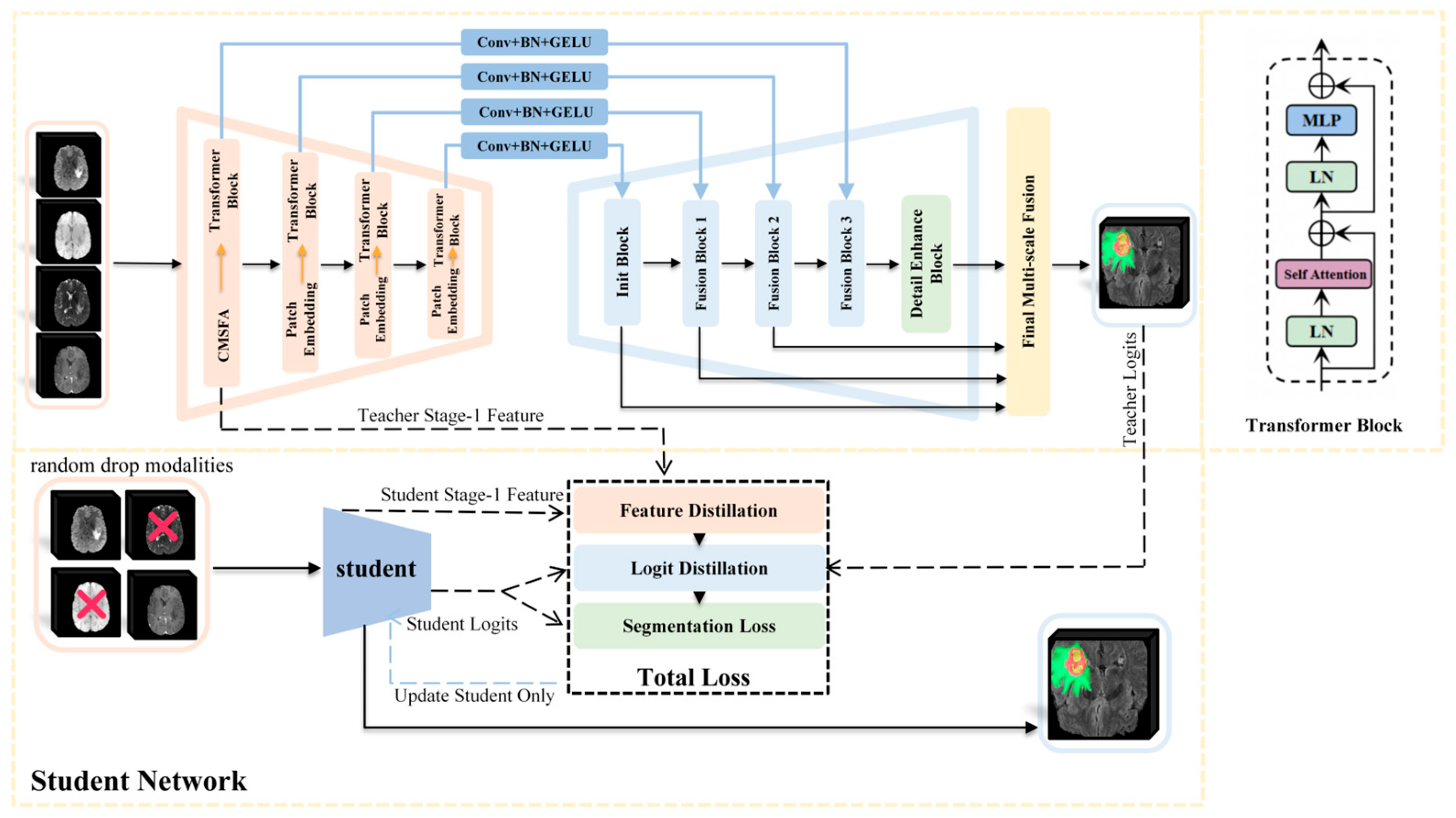 PF-CMNet: Progressive Frequency-Aware Cross-Modal Network with Missing ...