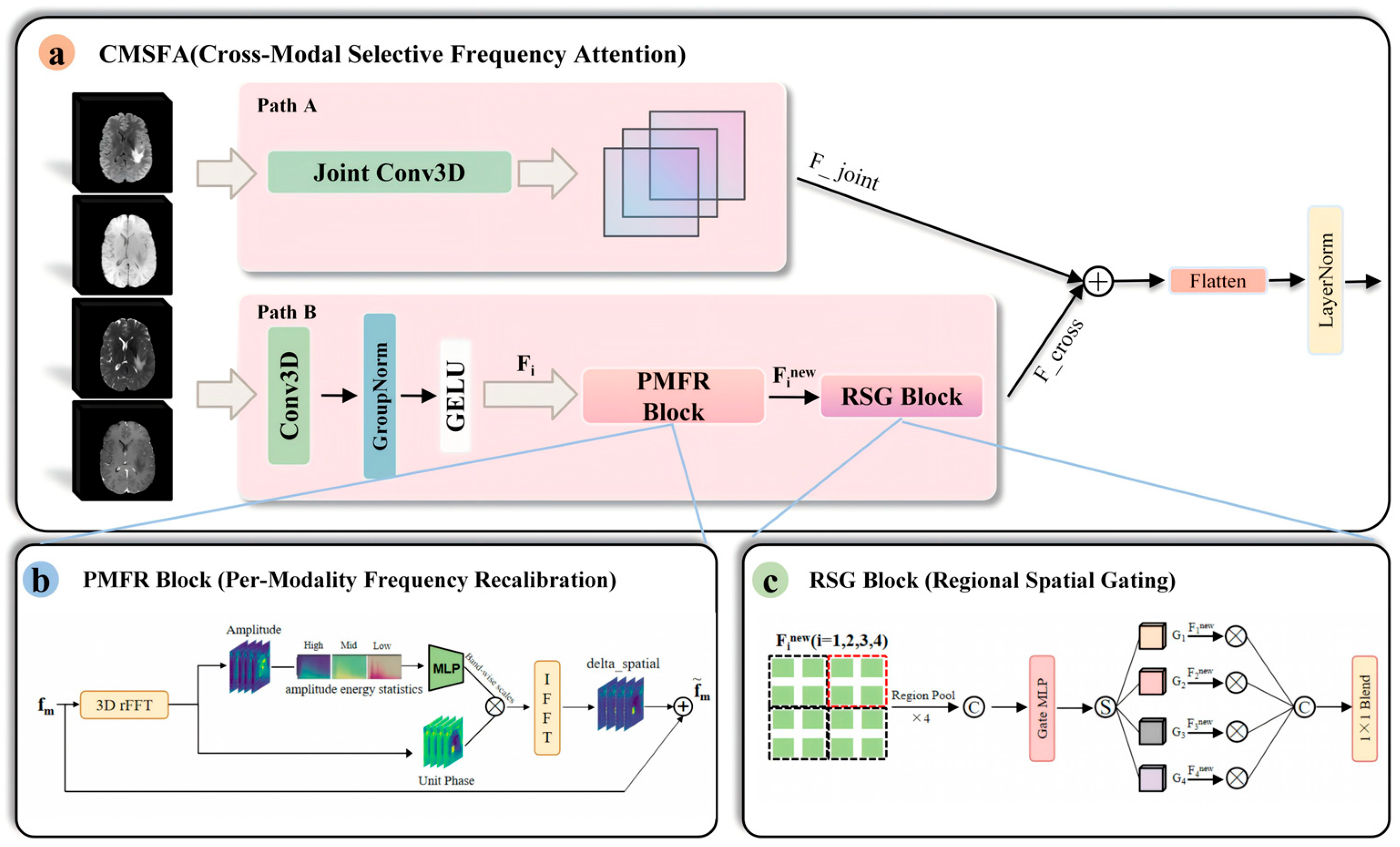 PF-CMNet: Progressive Frequency-Aware Cross-Modal Network with Missing ...