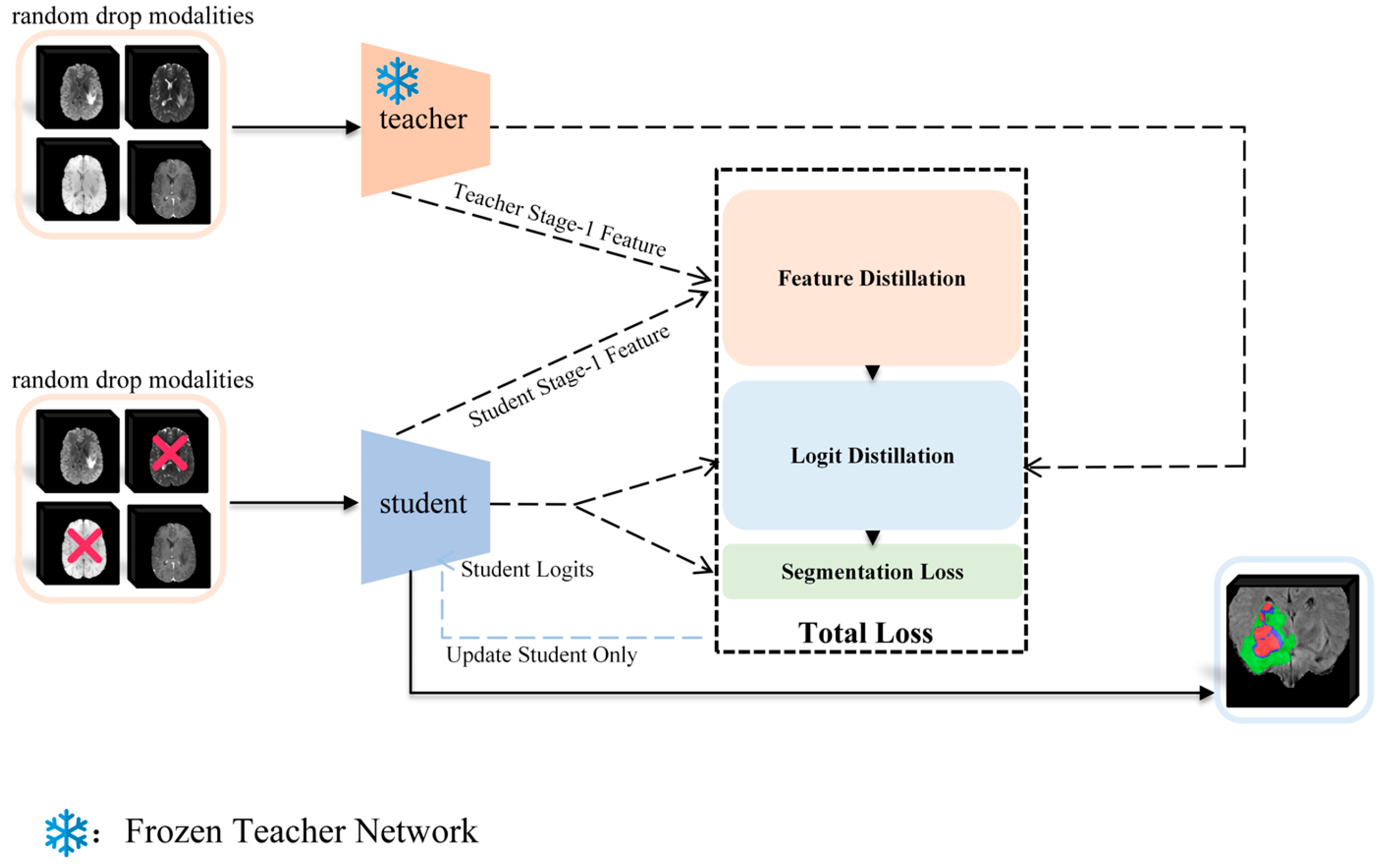 PF-CMNet: Progressive Frequency-Aware Cross-Modal Network with Missing ...