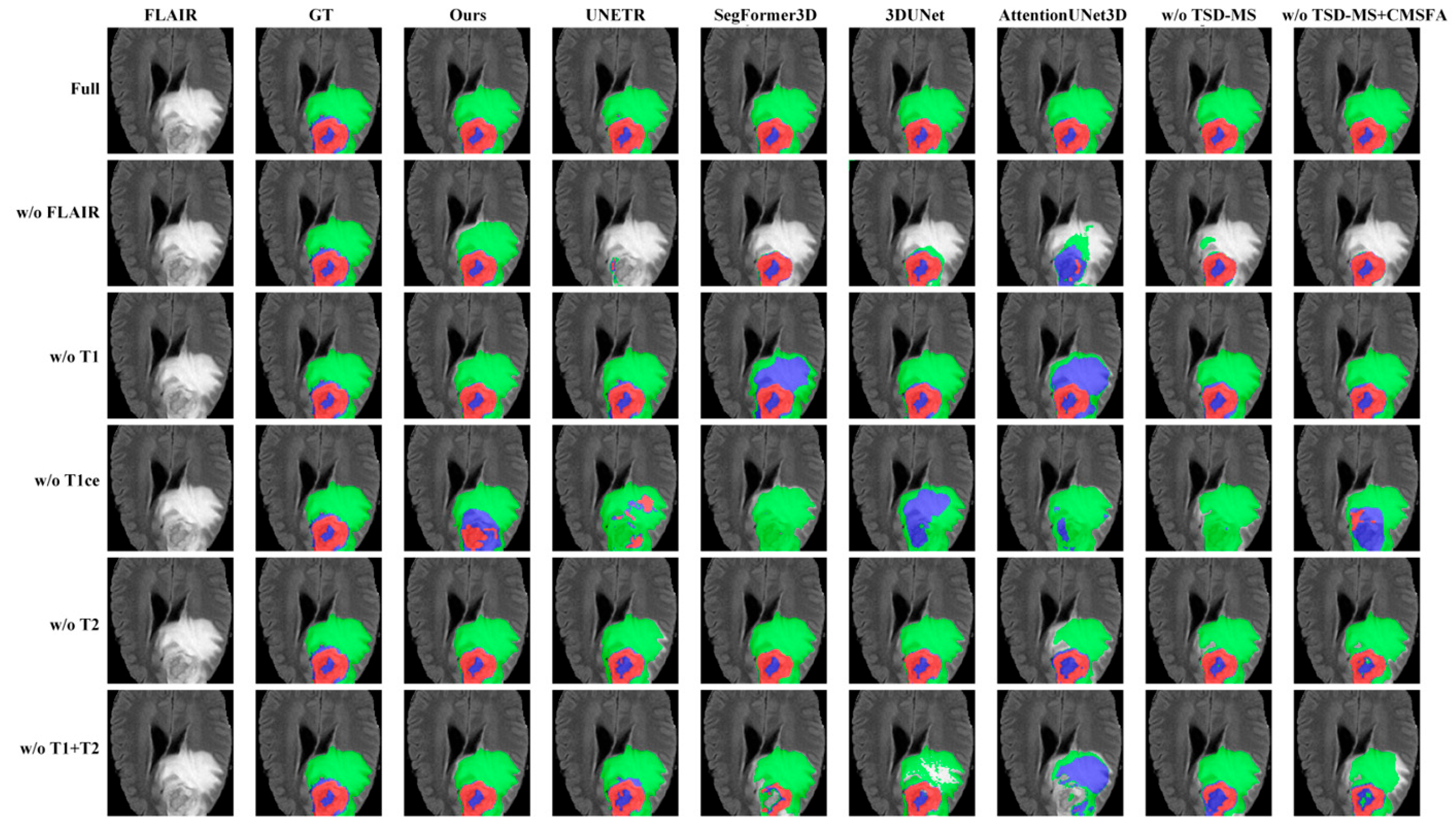PF-CMNet: Progressive Frequency-Aware Cross-Modal Network with Missing ...