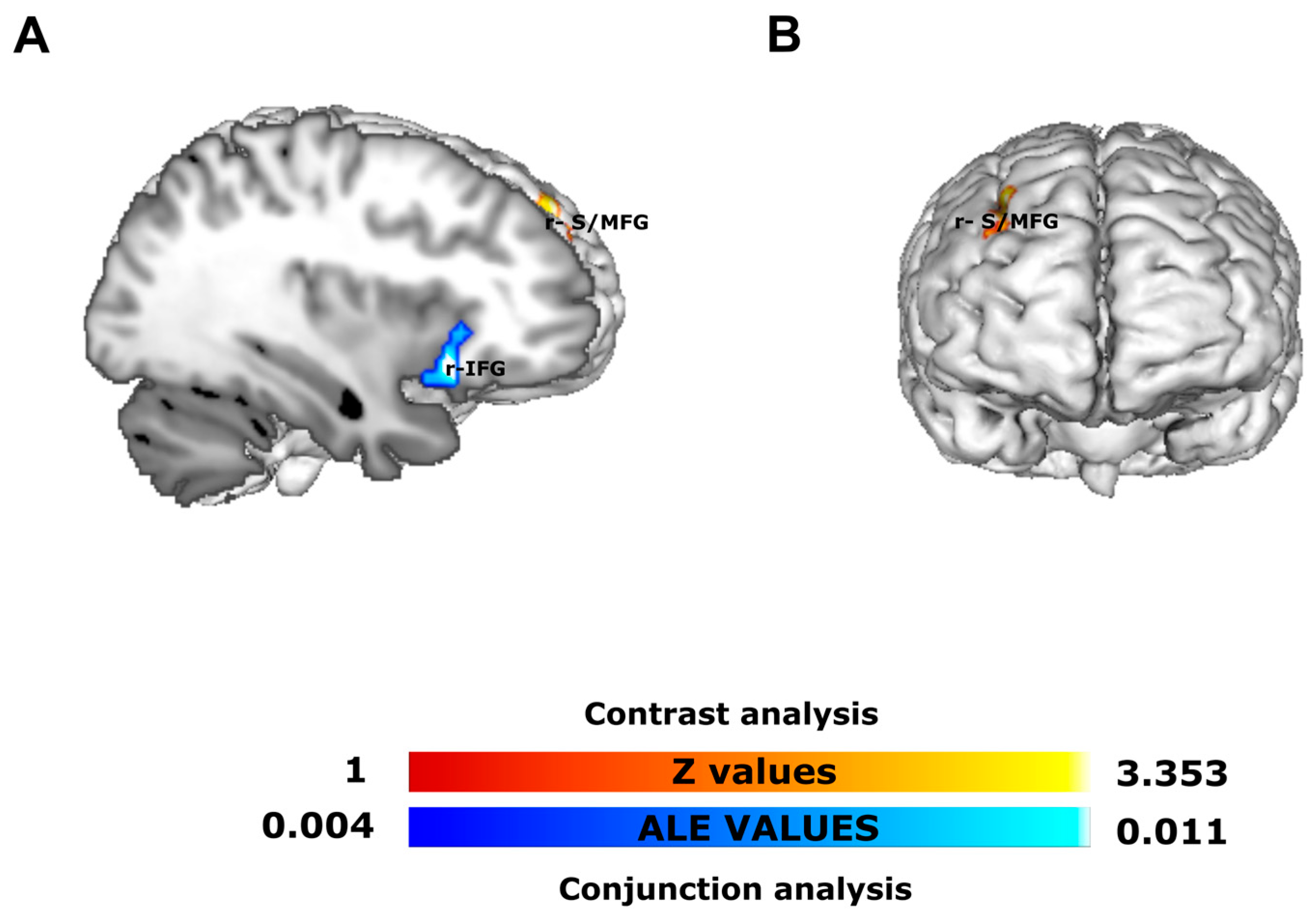 Neural Correlates of Inhibitory Control in Impulsivity Traits in Non ...